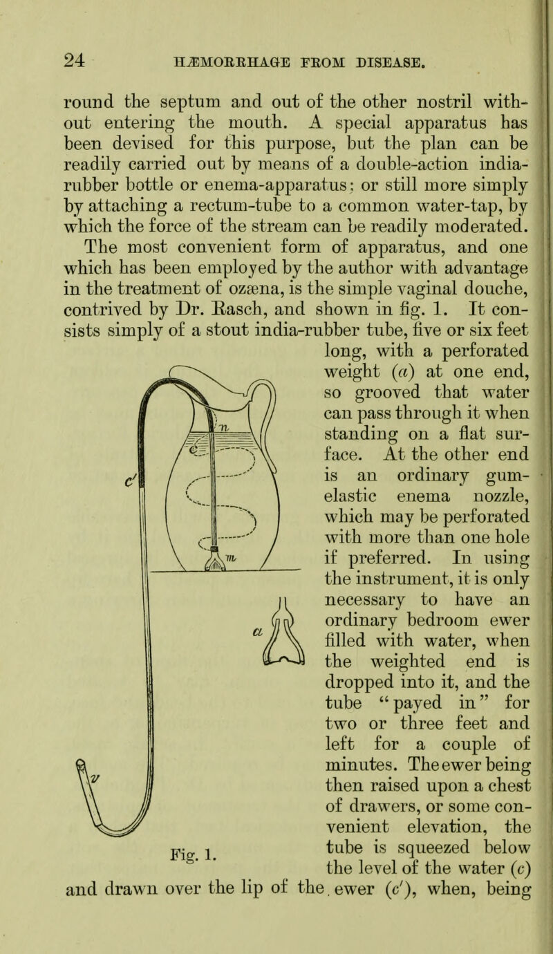 round the septum and out of the other nostril with- out entering the mouth. A special apparatus has been devised for this purpose, but the plan can be readily carried out by meaiis of a double-action india- rubber bottle or enema-apparatus: or still more simply by attaching a rectum-tube to a common water-tap, by which the force of the stream can be readily moderated. The most convenient form of apparatus, and one which has been employed by the author with advantage in the treatment of ozsena, is the simple vaginal douche, contrived by Dr. E-asch, and shown in fig. 1. It con- sists simply of a stout india-rubber tube, five or six feet long, with a perforated weight (a) at one end, so grooved that water can pass through it when standing on a flat sur- face. At the other end is an ordinary gum- elastic enema nozzle, which may be perforated with more than one hole if preferred. In using the instrument, it is only necessary to have an ordinary bedroom ewer filled with water, when the weighted end is dropped into it, and the tube payed in for two or three feet and left for a couple of minutes. The ewer being then raised upon a chest of drawers, or some con- venient elevation, the tube is squeezed below the level of the water (c) Fig. 1. and drawn over the lip of the. ewer (c'), when, being