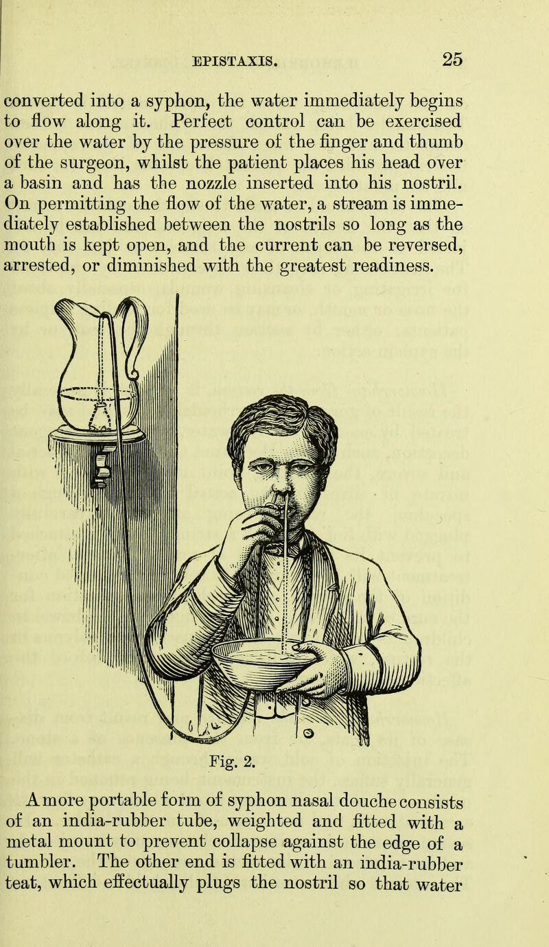 converted into a syphon, the water immediately begins to flow along it. Perfect control can be exercised over the water by the pressure of the finger and thumb of the surgeon, whilst the patient places his head over a basin and has the nozzle inserted into his nostril. On permitting the flow of the water, a stream is imme- diately established between the nostrils so long as the mouth is kept open, and the current can be reversed, arrested, or diminished with the greatest readiness. Fig. 2. A more portable form of syphon nasal douche consists of an india-rubber tube, weighted and fitted with a metal mount to prevent collapse against the edge of a tumbler. The other end is fitted with an india-rubber teat, which effectually plugs the nostril so that water