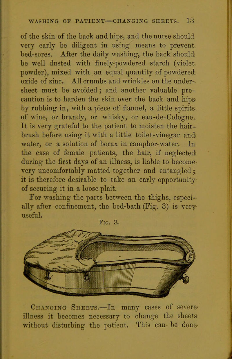 of the skin of the hack and hips, and the nurse should very early he dilig*ent in using* means to prevent, bed-sores. After the daily washing-, the hack should, be well dusted with finely-powdered starch (violet, powder), mixed with an equal quantity of powdered oxide of zinc. All crumbs and wrinkles on the under- sheet must be avoided; and another valuable pre- caution is to harden the skin over the back and hips by rubbing- in, with a piece of flannel, a little spirits, of wine, or brandy, or whisky, or eau-de-Colog-ne. It is very grateful to the patient to moisten the hair- brush before using- it with a little toilet-vinegar and< water, or a solution of borax in camphor-water. In the case of female patients, the hair, if neglected during- the first days of an illness, is liable to become- very uncomfortably matted together and entangled it is therefore desirable to take an early opportunity of securing it in a loose plait. For washing the parts between the thighs, especi- ally after confinement, the bed-bath (Fig*. 3) is very- useful. Fig. 3. Changing Sheets.—In many cases of severe* illness it becomes necessary to change the sheets without disturbing the patient. This can- he done-