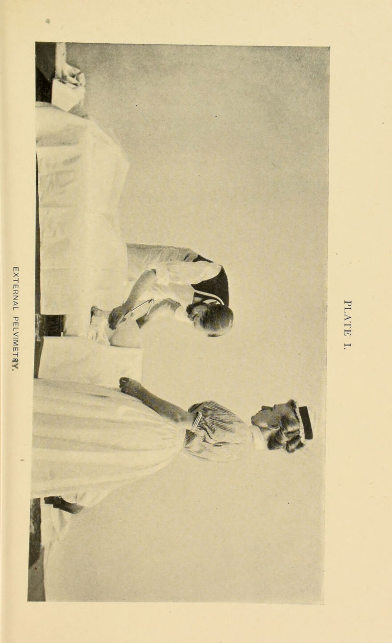 EXTERNAL PELVIMETHY. # PLATE