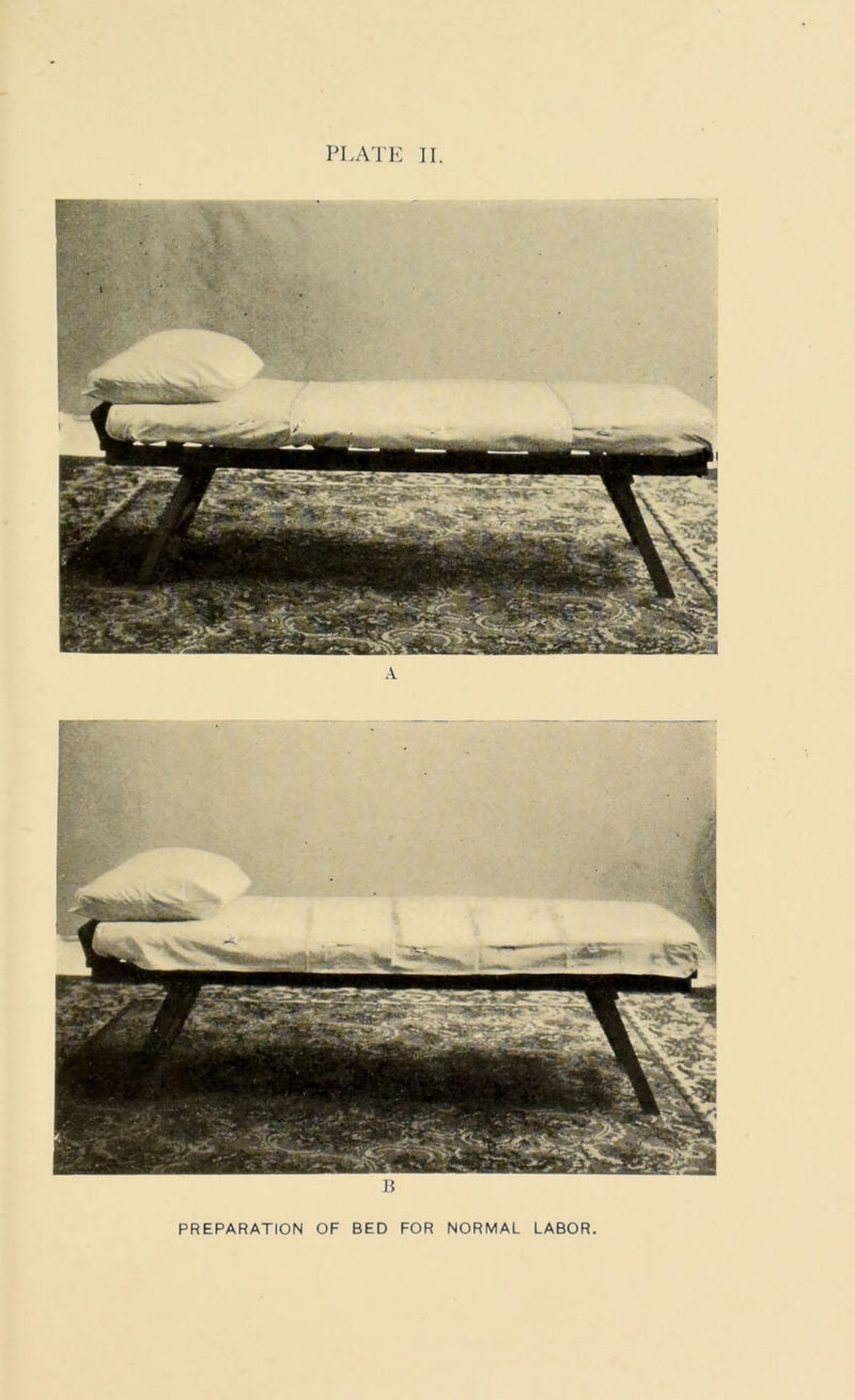 PLATE II PREPARATION OF BED FOR NORMAL LABOR