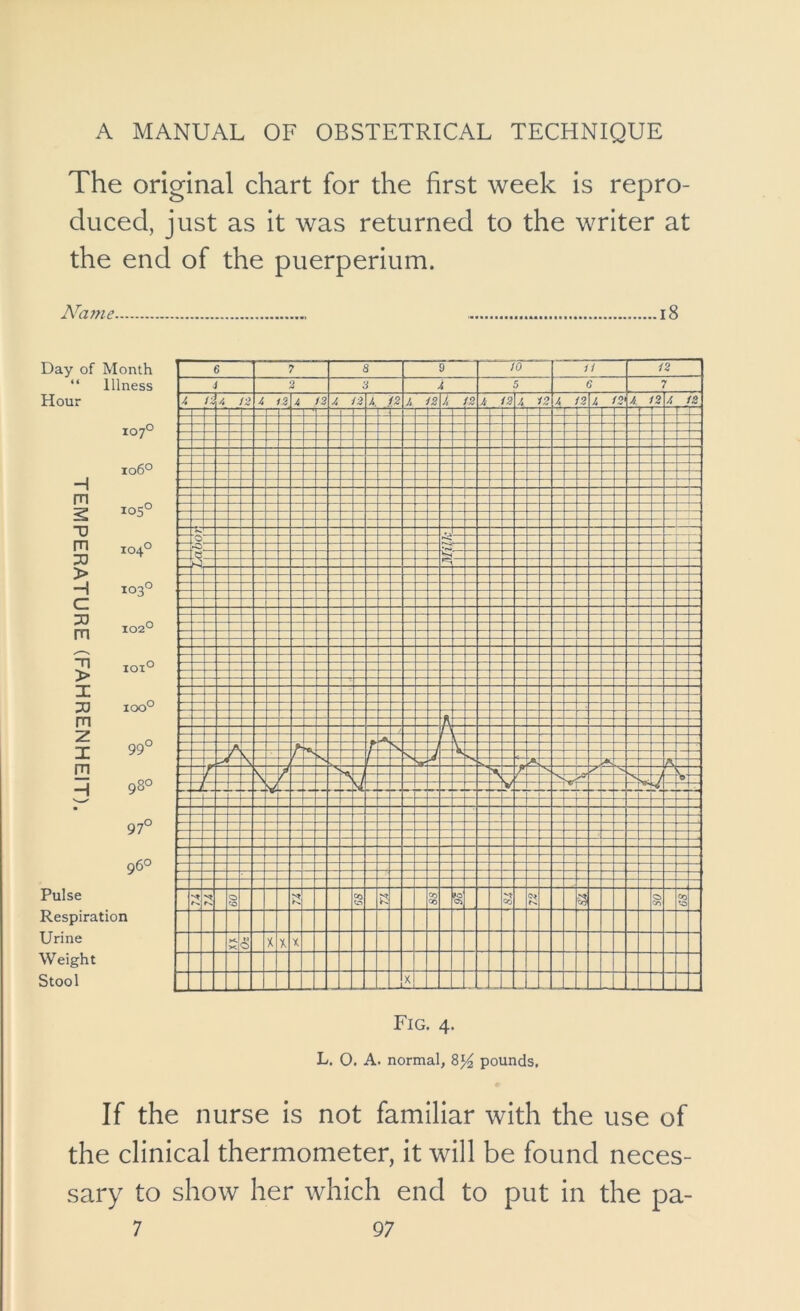 The original chart for the first week is repro- duced, just as it was returned to the writer at the end of the puerperium. N'ame i8 Day of Month “ Illness Hour 107° ^ 106° ^ 105° TJ m 104° 30 > 103° c m 5 loio I 33 IOO° m i 99° m 6 7 a 9 to H 42 4 3 3 3 5 6 7 i /i a 3 12 3 !2 3 f2 3, 3 f2 3 ^3 3 /3 3 —1— f2 3 r2 3 r2 3. 12 t2 — — — r~ T—“ 1 — - •c 7^ >0 A t: jk 1 A s V f < r L Lr «» \ / 3 H 98° 97° N 7 A . i A . .i V 1 96° 1— Pulse Respiration Urine Weight Stool '•0 CO cr* cc 'Oi Co Cb v> CO *-0 y<. X 0 X t X X Fig. 4. L. O. A. normal, pounds. If the nurse is not familiar with the use of the clinical thermometer, it will be found neces- sary to show her which end to put in the pa-