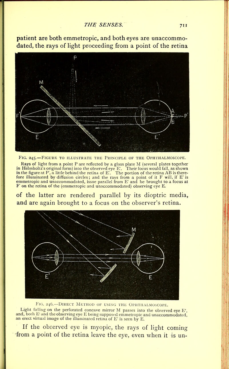 7i r patient are both emmetropic, and both eyes are unaccommo- dated, the rays of light proceeding from a point of the retina Fig. 245.—Figure to illustrate the Principle of the Ophthalmoscope. Rays of light from a point P are reflected by a glass plate M (several plates together in Helmholtz's original form) into the observed eye E\ Their focus would fall, as shown in the figure at P', a little behind the retina of E'. The portion of the retina AB is there- fore illuminated by diffusion circles; and the rays from a point of it F will, if E'is emmetropic and unaccommodated, issue parallel from E' and be brought to a focus at F' on the retina of the (emmetropic and unaccommodated) observing eye E. of the latter are rendered parallel by its dioptric media, and are again brought to a focus on the observer’s retina. Fig. 246.—Direct Method of using the Ophthalmoscope. Light falling on the perforated concave mirror M passes into the observed eye E', and, both E' and the observing eye E being supposed emmetropic and unaccommodated, an erect virtual image of the illuminated retina of E' is seen by E. If the observed eye is myopic, the rays of light coming ■from a point of the retina leave the eye, even when it is un-