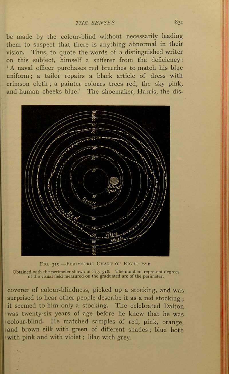 be made by the colour-blind without necessarily leading them to suspect that there is anything abnormal in their vision. Thus, to quote the words of a distinguished writer on this subject, himself a sufferer from the deficiency: ‘ A naval officer purchases red breeches to match his blue uniform; a tailor repairs a black article of dress with crimson cloth ; a painter colours trees red, the sky pink, and human cheeks blue.’ The shoemaker, Harris, the dis- of the visual field measured on the graduated arc of the perimeter, coverer of colour-blindness, picked up a stocking, and was surprised to hear other people describe it as a red stocking ; it seemed to him only a stocking. The celebrated Dalton was twenty-six years of age before he knew that he was colour-blind. He matched samples of red, pink, orange, I and brown silk with green of different shades ; blue both with pink and with violet ; lilac with grey.
