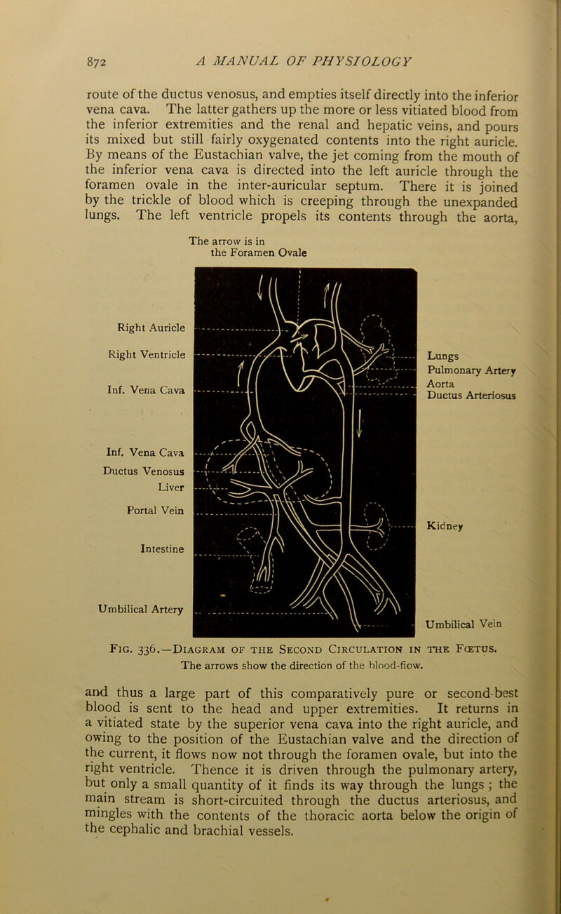 route of the ductus venosus, and empties itself directly into the inferior vena cava. The latter gathers up the more or less vitiated blood from the inferior extremities and the renal and hepatic veins, and pours its mixed but still fairly oxygenated contents into the right auricle. By means of the Eustachian valve, the jet coming from the mouth of the inferior vena cava is directed into the left auricle through the foramen ovale in the inter-auricular septum. There it is joined by the trickle of blood which is creeping through the unexpanded lungs. The left ventricle propels its contents through the aorta, The arrow is in the Foramen Ovale Right Auricle Right Ventricle Inf. Vena Cava Inf. Vena Cava Ductus Venosus Liver Portal Vein Intestine Umbilical Artery Lungs Pulmonary Artery Aorta Ductus Arteriosus Kidney Umbilical Vein Fig. 336.—Diagram of the Second Circulation in the Fcetus. The arrows show the direction of the blood-flow. and thus a large part of this comparatively pure or second-best blood is sent to the head and upper extremities. It returns in a vitiated state by the superior vena cava into the right auricle, and owing to the position of the Eustachian valve and the direction of the current, it flows now not through the foramen ovale, but into the right ventricle. Thence it is driven through the pulmonary artery, but only a small quantity of it finds its way through the lungs ; the main stream is short-circuited through the ductus arteriosus, and mingles with the contents of the thoracic aorta below the origin of the cephalic and brachial vessels.
