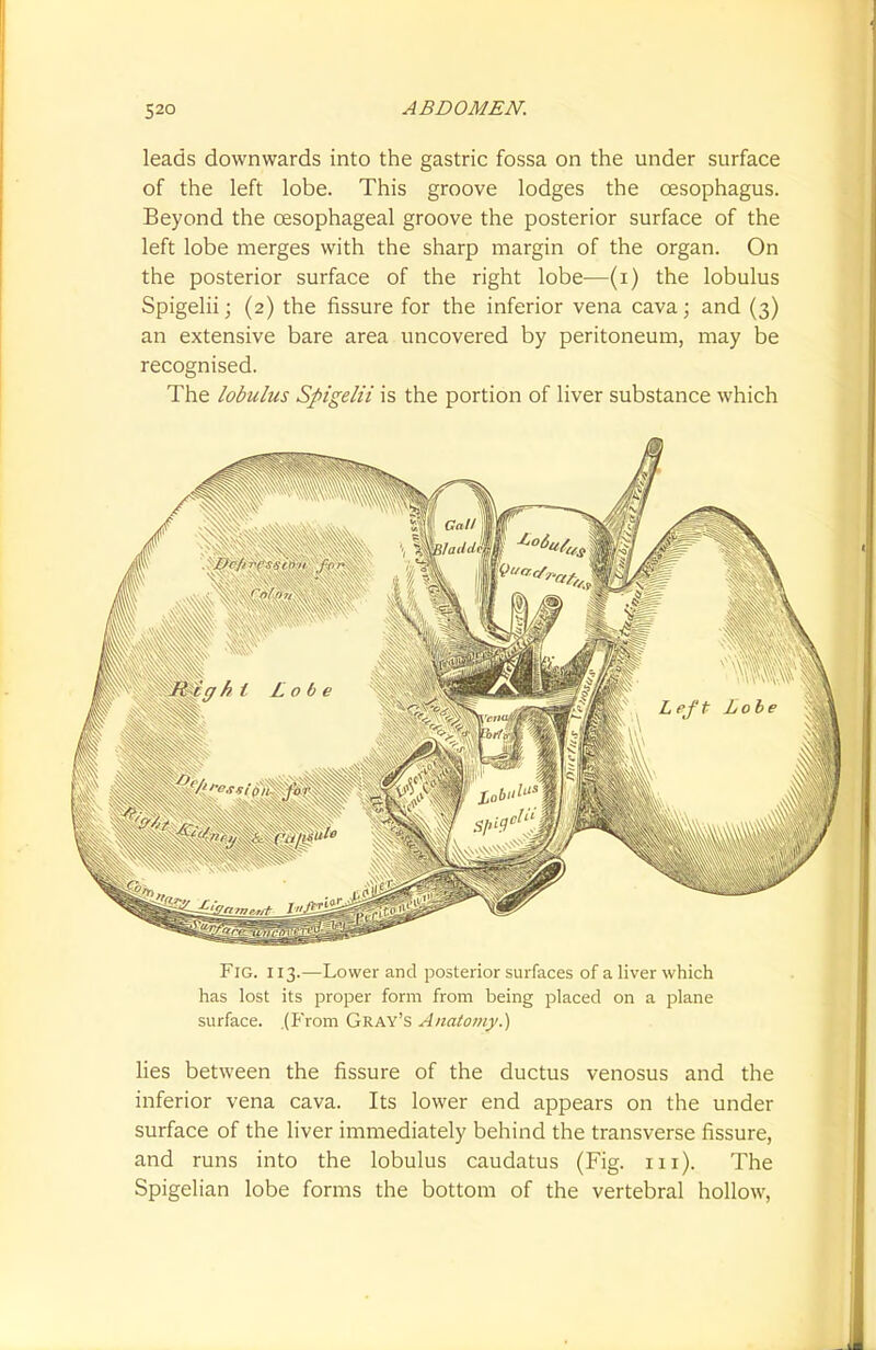 leads downwards into the gastric fossa on the under surface of the left lobe. This groove lodges the oesophagus. Beyond the oesophageal groove the posterior surface of the left lobe merges with the sharp margin of the organ. On the posterior surface of the right lobe—(i) the lobulus Spigelii; (2) the fissure for the inferior vena cava; and (3) an extensive bare area uncovered by peritoneum, may be recognised. The lobulus Spigelii is the portion of liver substance which Fig. 113.—Lower and posterior surfaces of a liver which has lost its proper form from being placed on a plane surface. (P'rom Gray's Anatomy.) lies between the fissure of the ductus venosus and the inferior vena cava. Its lower end appears on the under surface of the liver immediately behind the transverse fissure, and runs into the lobulus caudatus (Fig. 111). The Spigelian lobe forms the bottom of the vertebral hollow,