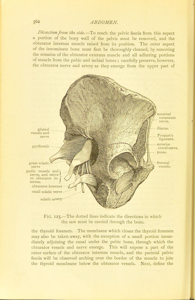 Dissection from the side.—To reach the pelvic fascia from this aspect a portion of the bony wall of the pelvis must be removed, and the obturator internus muscle raised from its position. The outer aspect of the innominate bone must first be thoroughly cleaned, by removing the remains of the obturator externus muscle and all adhering portions of muscle from the pubic and ischial bones ; carefully preserve, however, the obturator nerve and artery as they emerge from the upper part of Fig. 125.—The dotted lines indicate the directions in which the saw must be carried through the bone. the thyroid foramen. The membrane which closes the thyroid foramen may also be taken away, with the exception of a small portion imme- diately adjoining the canal under the pubic bone, through which the obturator vessels and nerve emerge. This will expose a part of the outer surface of the obturator internus muscle, and the parietal pelvic fascia will be observed arching over the border of the muscle to join the thyroid membrane below the obturator vessels. Next, define the