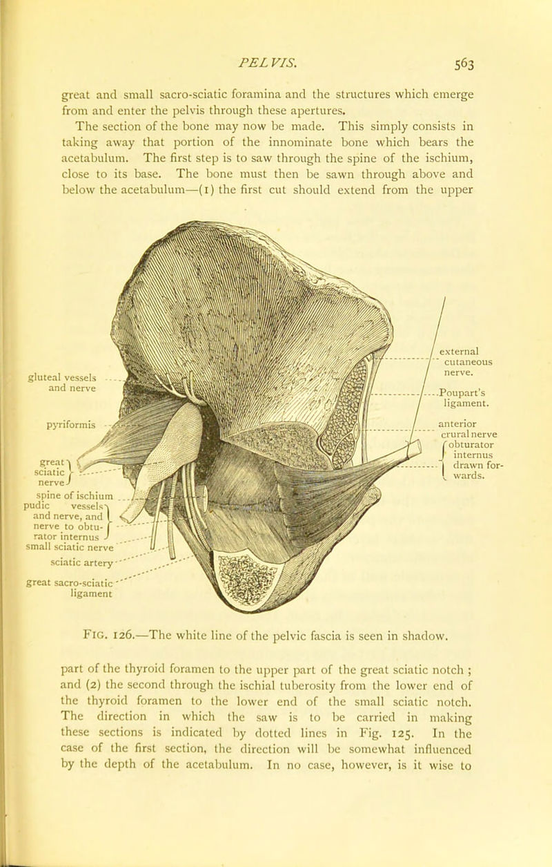 great and small sacro-sciatic foramina and the structures which emerge from and enter the pelvis through these apertures. The section of the bone may now be made. This simply consists in taking away that portion of the innominate bone which bears the acetabulum. The first step is to saw through the spine of the ischium, close to its base. The bone must then be sawn through above and below the acetabulum—(1) the first cut should extend from the upper gluteal vessels and nerve pyriformis greats \ i?*ssm sciatic J- r.- nerve-' spine of ischium pudic vessels and nerve, and nerve to obtu- rator internus small sciatic nerve sciatic artery great sacro-sciatic '*' ligament external / cutaneous nerve. Poupart's ligament. anterior crural nerve /obturator internus drawn for- wards. Fig. 126.—The white line of the pelvic fascia is seen in shadow. part of the thyroid foramen to the upper part of the great sciatic notch ; and (2) the second through the ischial tuberosity from the lower end of the thyroid foramen to the lower end of the small sciatic notch. The direction in which the saw is to be carried in making these sections is indicated by dotted lines in Fig. 125. In the case of the first section, the direction will be somewhat influenced by the depth of the acetabulum. In no case, however, is it wise to