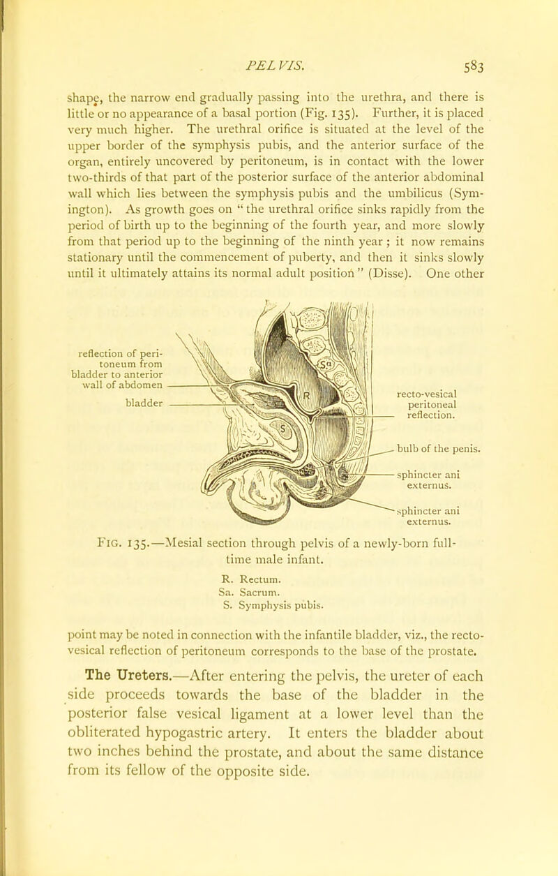 shape, the narrow end gradually passing into the urethra, and there is little or no appearance of a basal portion (Fig. 135). Further, it is placed very much higher. The urethral orifice is situated at the level of the upper border of the symphysis pubis, and the anterior surface of the organ, entirely uncovered by peritoneum, is in contact with the lower two-thirds of that part of the posterior surface of the anterior abdominal wall which lies between the symphysis pubis and the umbilicus (Sym- ington). As growth goes on  the urethral orifice sinks rapidly from the period of birth up to the beginning of the fourth year, and more slowly from that period up to the beginning of the ninth year ; it now remains stationary until the commencement of puberty, and then it sinks slowly until it ultimately attains its normal adult position  (Disse). One other Fig. 135.—Mesial section through pelvis of a newly-born full- time male infant. R. Rectum. Sa. Sacrum. S. Symphysis pubis. point may be noted in connection with the infantile bladder, viz., the recto- vesical reflection of peritoneum corresponds to the base of the prostate. The Ureters.—After entering the pelvis, the ureter of each side proceeds towards the base of the bladder in the posterior false vesical ligament at a lower level than the obliterated hypogastric artery. It enters the bladder about two inches behind the prostate, and about the same distance from its fellow of the opposite side.