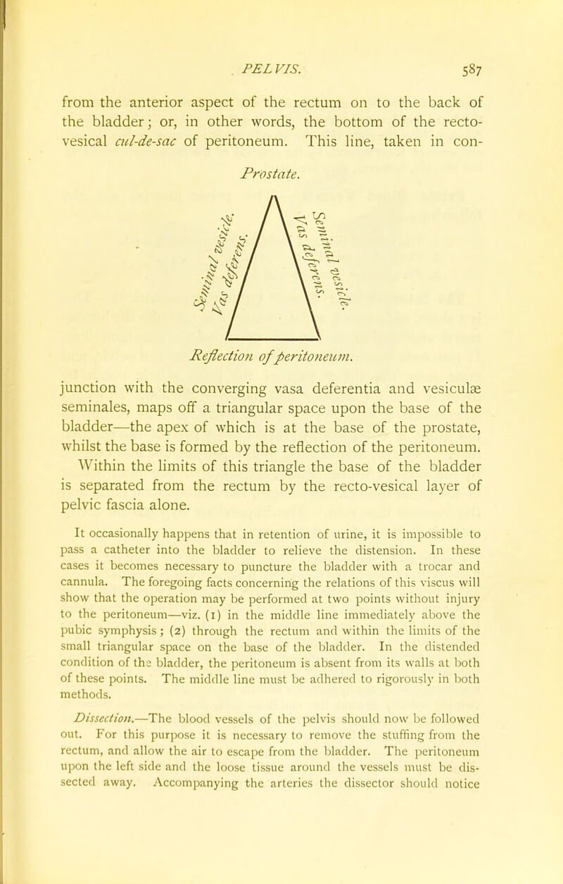from the anterior aspect of the rectum on to the back of the bladder; or, in other words, the bottom of the recto- vesical cul-de-sac of peritoneum. This line, taken in con- Prostate. Reflection of peritoneum. junction with the converging vasa deferentia and vesicuke seminales, maps off a triangular space upon the base of the bladder—the apex of which is at the base of the prostate, whilst the base is formed by the reflection of the peritoneum. Within the limits of this triangle the base of the bladder is separated from the rectum by the recto-vesical layer of pelvic fascia alone. It occasionally happens that in retention of urine, it is impossible to pass a catheter into the bladder to relieve the distension. In these cases it becomes necessary to puncture the bladder with a trocar and cannula. The foregoing facts concerning the relations of this viscus will show that the operation may be performed at two points without injury to the peritoneum—viz. (i) in the middle line immediately above the pubic symphysis ; (2) through the rectum and within the limits of the small triangular space on the base of the bladder. In the distended condition of thj bladder, the peritoneum is absent from its walls at both of these points. The middle line must be adhered to rigorously in both methods. Dissection.—The blood vessels of the pelvis should now be followed out. For this purpose it is necessary to remove the stuffing from the rectum, and allow the air to escape from the bladder. The peritoneum upon the left side and the loose tissue around the vessels must be dis- sected away. Accompanying the arteries the dissector should notice