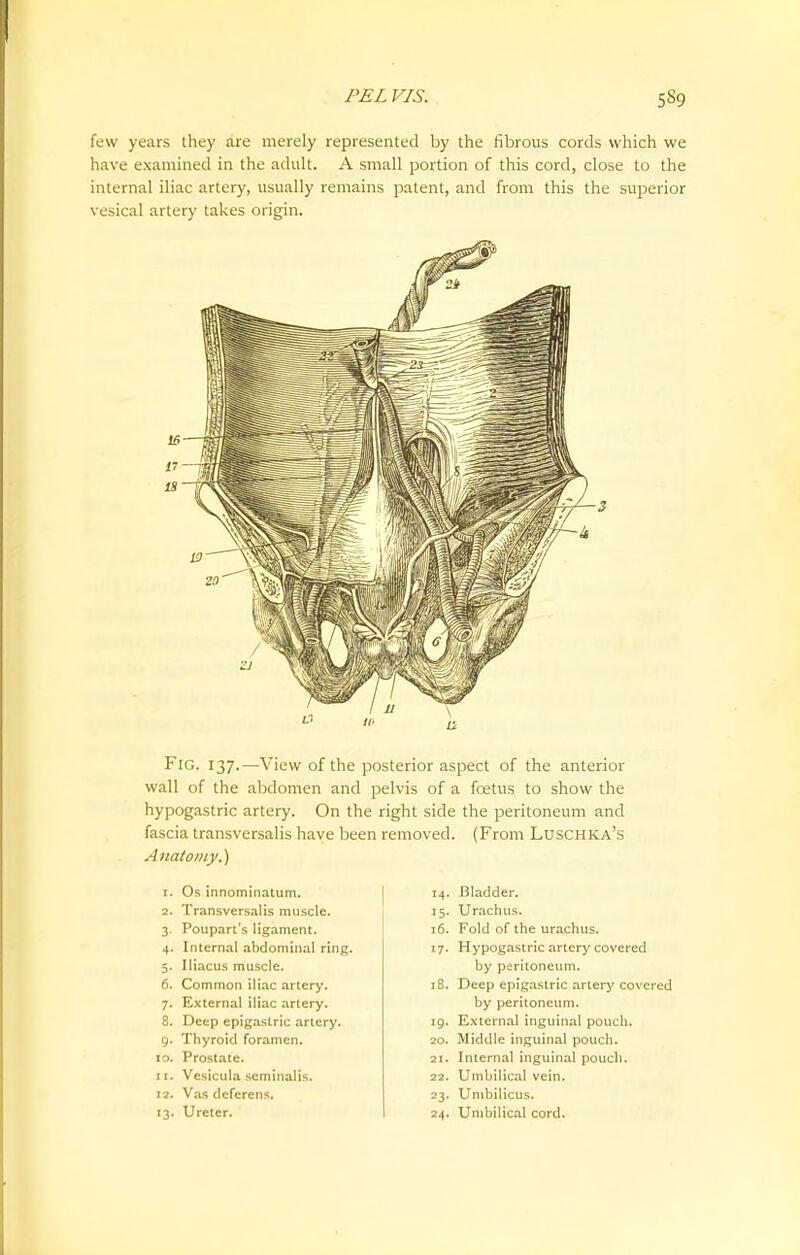 few years they are merely represented by the fibrous cords which we have examined in the adult. A small portion of this cord, close to the internal iliac artery, usually remains patent, and from this the superior vesical artery takes origin. Fig. 137.—View of the posterior aspect of the anterior wall of the abdomen and pelvis of a foetus to show the hypogastric artery. On the right side the peritoneum and fascia transversalis have been removed. (From Luschka's Anatomy.) 1. Os innominatum. 2. Transversalis muscle. 3. Poupart's ligament. 4. Internal abdominal ring. 5. Iliacus muscle. 6. Common iliac artery. 7. External iliac artery. 8. Deep epigastric artery. 9. Thyroid foramen. 10. Prostate. 11. Vcsicula scminalis. 12. Vas deferens. 13. Ureter. 14. Bladder. 15. Urachus. 16. Fold of the urachus. 17. Hypogastric artery covered by peritoneum. 18. Deep epigastric artery covered by peritoneum. 19. External inguinal pouch. 20. Middle inguinal pouch. 21. Internal inguinal pouch. 22. Umbilical vein. 23. Umbilicus. 24. Umbilical cord.