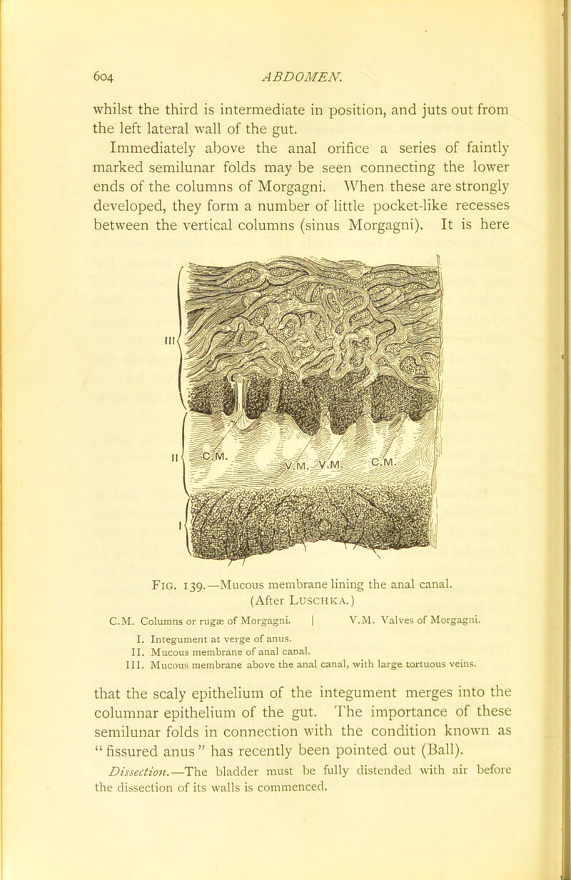 whilst the third is intermediate in position, and juts out from the left lateral wall of the gut. Immediately above the anal orifice a series of faintly marked semilunar folds may be seen connecting the lower ends of the columns of Morgagni. When these are strongly developed, they form a number of little pocket-like recesses between the vertical columns (sinus Morgagni). It is here Fig. 139.—Mucous membrane lining the anal canal. (After Luschka.) CM. Columns or ruga; of Morgagni. | V.M. Valves of Morgagni. I. Integument at verge of anus. II. Mucous membrane of anal canal. III. Mucous membrane above the anal canal, with large tortuous veins. that the scaly epithelium of the integument merges into the columnar epithelium of the gut. The importance of these semilunar folds in connection with the condition known as  fissured anus  has recently been pointed out (Ball). Dissection.—The bladder must be fully distended with air before the dissection of its walls is commenced.