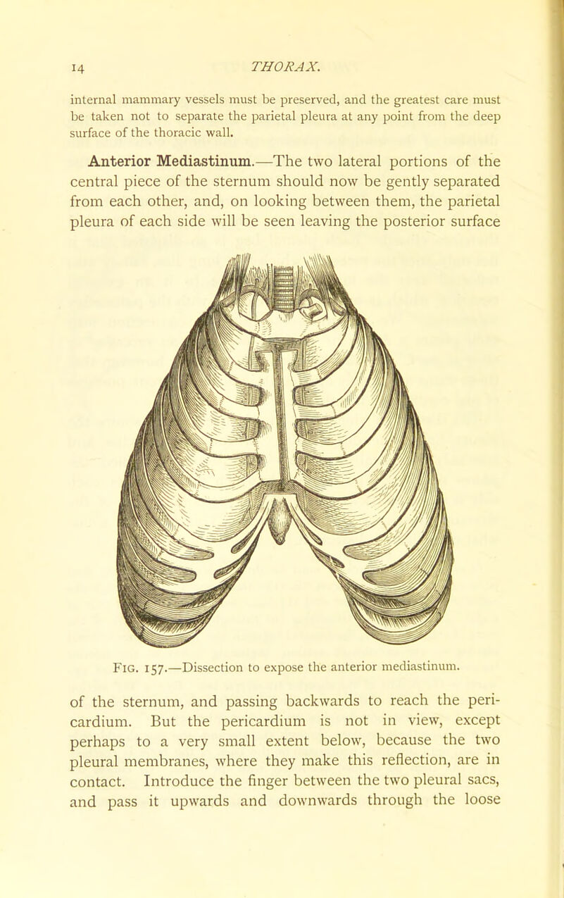 internal mammary vessels must be preserved, and the greatest care must be taken not to separate the parietal pleura at any point from the deep surface of the thoracic wall. Anterior Mediastinum.—The two lateral portions of the central piece of the sternum should now be gently separated from each other, and, on looking between them, the parietal pleura of each side will be seen leaving the posterior surface Fig. 157.—Dissection to expose the anterior mediastinum. of the sternum, and passing backwards to reach the peri- cardium. But the pericardium is not in view, except perhaps to a very small extent below, because the two pleural membranes, where they make this reflection, are in contact. Introduce the finger between the two pleural sacs, and pass it upwards and downwards through the loose