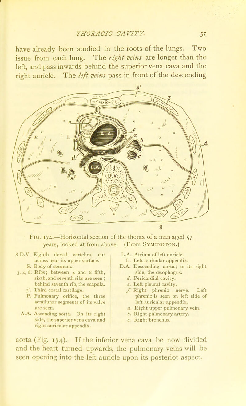 THORACIC CAVITY. 57 have already been studied in the roots of the lungs. Two issue from each lung. The right veins are longer than the left, and pass inwards behind the superior vena cava and the right auricle. The left veins pass in front of the descending Fig. 174.—Horizontal section of the thorax of a man aged 57 years, looked at from above. (From Symington.) 3. 4i 8 D.V. Eighth dorsal vertebra, cut across near its upper surface. S. Body of sternum. Ribs; between 4 and 8 fifth, sixth, and seventh ribs are seen ; behind seventh rib, the scapula. Third costal cartilage. Pulmonary orifice, the three semilunar segments of its valve are seen. A.A. Ascending aort.-i. On its right side, the superior vena cava and right auricular appendix. 3 • P. L.A. Atrium of left auricle. L. Left auricular appendix. D.A. Descending aorta; to its right side, the cesophagus. d. Pericardial cavity. e. Left pleural cavity. /. Right phrenic nerve. Left phrenic is seen on left side of left auricular .-ippendix. a. Right upper pulmonary vein. /'. Right pulmonary artery. c. Right bronchus. aorta (Fig. 174). If the inferior vena cava be now divided and the heart turned upwards, the pulmonary veins will be seen opening into the left auricle upon its posterior aspect.