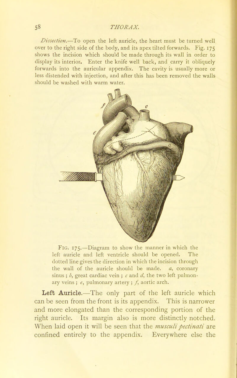 Dissection.—To open the left auricle, the heart must be turned well over to the right side of the body, and its apex tilted forwards. Fig. 175 shows the incision which should be made through its wall in order to display its interior. Enter the knife well back, and carry it obliquely forwards into the auricular appendix. The cavity is usually more or less distended with injection, and after this has been removed the walls should be washed with warm water. Fig. 175.—Diagram to show the manner in which the left auricle and left ventricle should be opened. The dotted line gives the direction in which the incision through the wall of the auricle should be made. a, coronary sinus ; b, great cardiac vein ; c and a', the two left pulmon- ary veins ; e, pulmonary artery ; /, aortic arch. Left Auricle.—The only part of the left auricle which can be seen from the front is its appendix. This is narrower and more elongated than the corresponding portion of the right auricle. Its margin also is more distinctly notched. When laid open it will be seen that the inusculipectimiti are confined entirely to the appendix. Everywhere else the