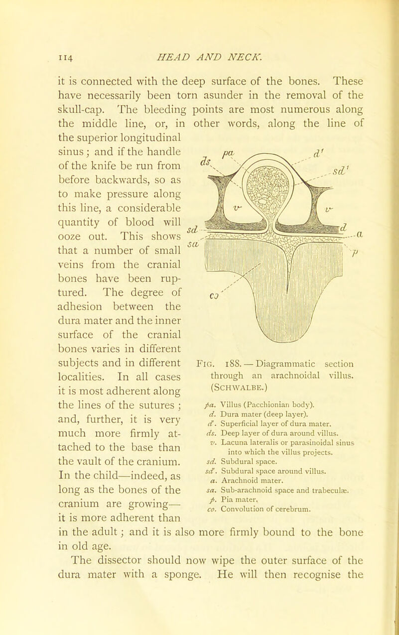 it is connected with the deep surface of the bones. These have necessarily been torn asunder in the removal of the skull-cap. The bleeding points are most numerous along the middle line, or, in other words, along the line of the superior longitudinal sinus ; and if the handle of the knife be run from before backwards, so as to make pressure along this line, a considerable quantity of blood will ooze out. This shows that a number of small veins from the cranial bones have been rup- tured. The degree of adhesion between the dura mater and the inner surface of the cranial bones varies in different subjects and in different localities. In all cases it is most adherent along the lines of the sutures ; and, further, it is very much more firmly at- tached to the base than the vault of the cranium. In the child—indeed, as long as the bones of the cranium are growing— it is more adherent than in the adult; and it is also more firmly bound to the bone in old age. The dissector should now wipe the outer surface of the dura mater with a sponge. He will then recognise the Fig. i88. — Diagrammatic through an arachnoidal (SCHWALBE.) section villus. pa. Villus (Pacchionian body). d. Dura mater (deep layer). d. Superficial layer of dura mater. ds. Deep layer of dura around villus. XI. Lacuna lateralis or parasinoidal sinus into which the villus projects. sd. Subdural space. sd'. Subdural space around villus. a. Arachnoid mater. sa. Sub-arachnoid space and trabecula;. /. Pia mater. CO. Convolution of cerebrum.