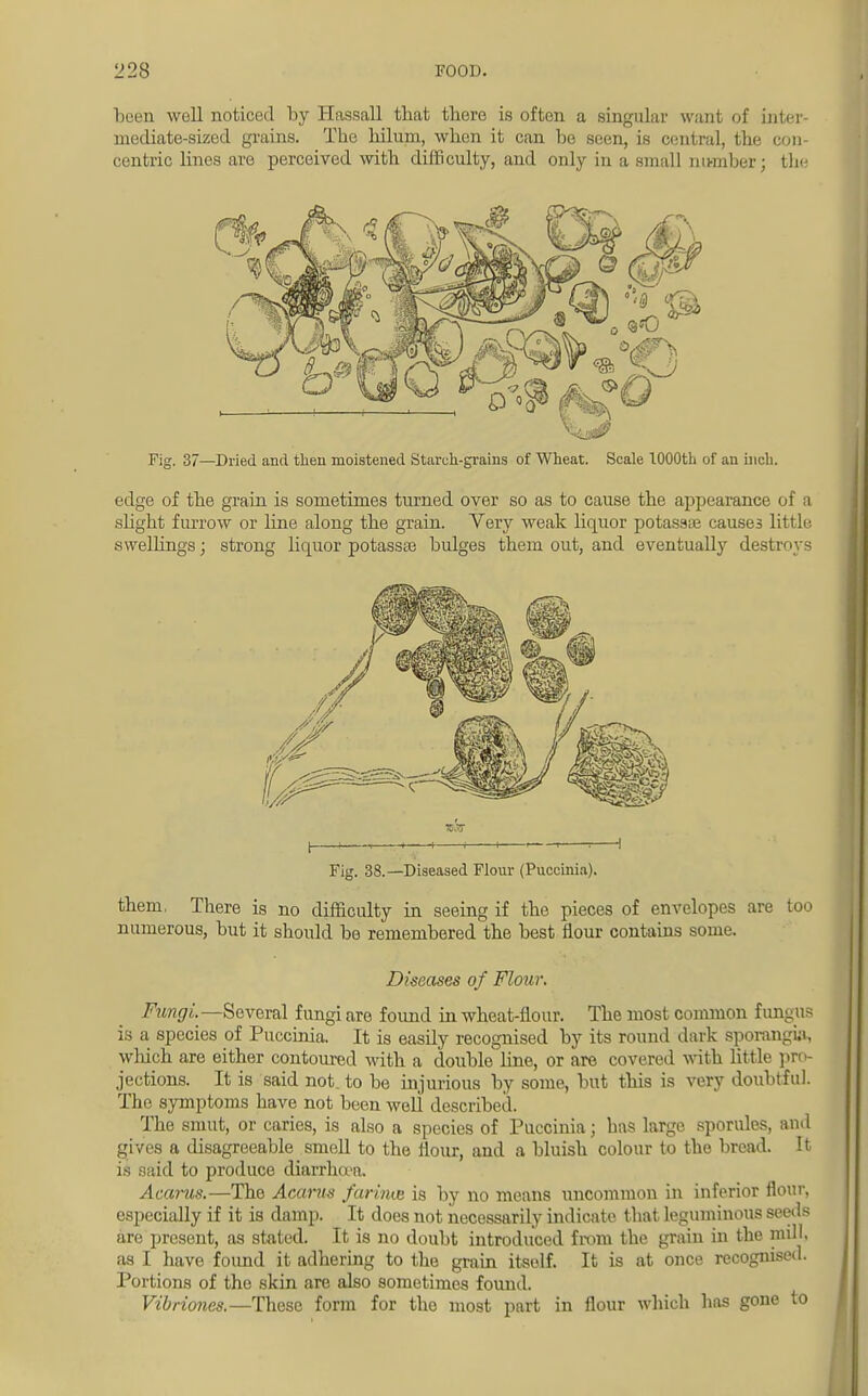 been well noticed by ITassall tbat there is often a singular want of inter- mediate-sized grains. Tbe hiluni, when it can be seen, is central, the con- centric lines are perceived with difficulty, and only in a small number; tin- Fig. 37—Dried and then moistened Starch-grains of Wheat. Scale 1000th of an inch. edge of the grain is sometimes turned over so as to cause the appearance of a slight furrow or line along the grain. Very weak liquor potassae causes little swellings; strong liquor potass* bulges them out, and eventually destroys Fig. 38.—Diseased Flour (Puccinia). them, There is no difficulty in seeing if the pieces of envelopes are too numerous, but it should be remembered the best flour contains some. Diseases of Flour. Fungi.— Several fungi are found in wheat-flour. The most common fungus is a species of Puccinia. It is easily recognised by its round dark sporangia, which are either contoured with a double line, or are covered with little pro- jections. It is said not. to be injurious by some, but this is very doubtful. The symptoms have not been weli described. The smut, or caries, is also a species of Puccinia; has large sporules, and gives a disagreeable smell to the flour, and a bluish colour to the bread. It is said to produce diarrhoea. Acarus.—Tho Acarius farina is by no means uncommon in inferior flour, especially if it is damp. It does not necessarily indicate that leguminous seeds are present, as stated. It is no doubt introduced from the grain in the mill, as I have found it adhering to the grain itself. It is at once recognised. Portions of the skin are also sometimes found. Vibriones.—These form for the most part in flour which has gone to