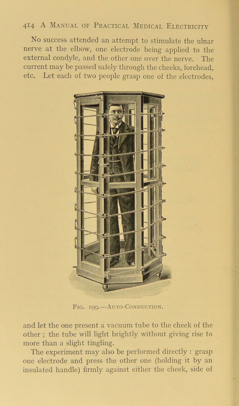 No success attended an attempt to stimulate the ulnar nerve at the elbow, one electrode being applied to the external condyle, and the other one over the nerve. The current may be passed safely through the cheeks, forehead, etc. Let each of two people grasp one of the electrodes. Fig. 199.—Auto-Conduction. and let the one present a vacuum tube to the cheek of the other ; the tube will light brightly without giving rise to more than a slight tingling. The experiment may also be performed directly : grasp one electrode and press the other one (holding it by an insulated handle) firmly against either the cheek, side of