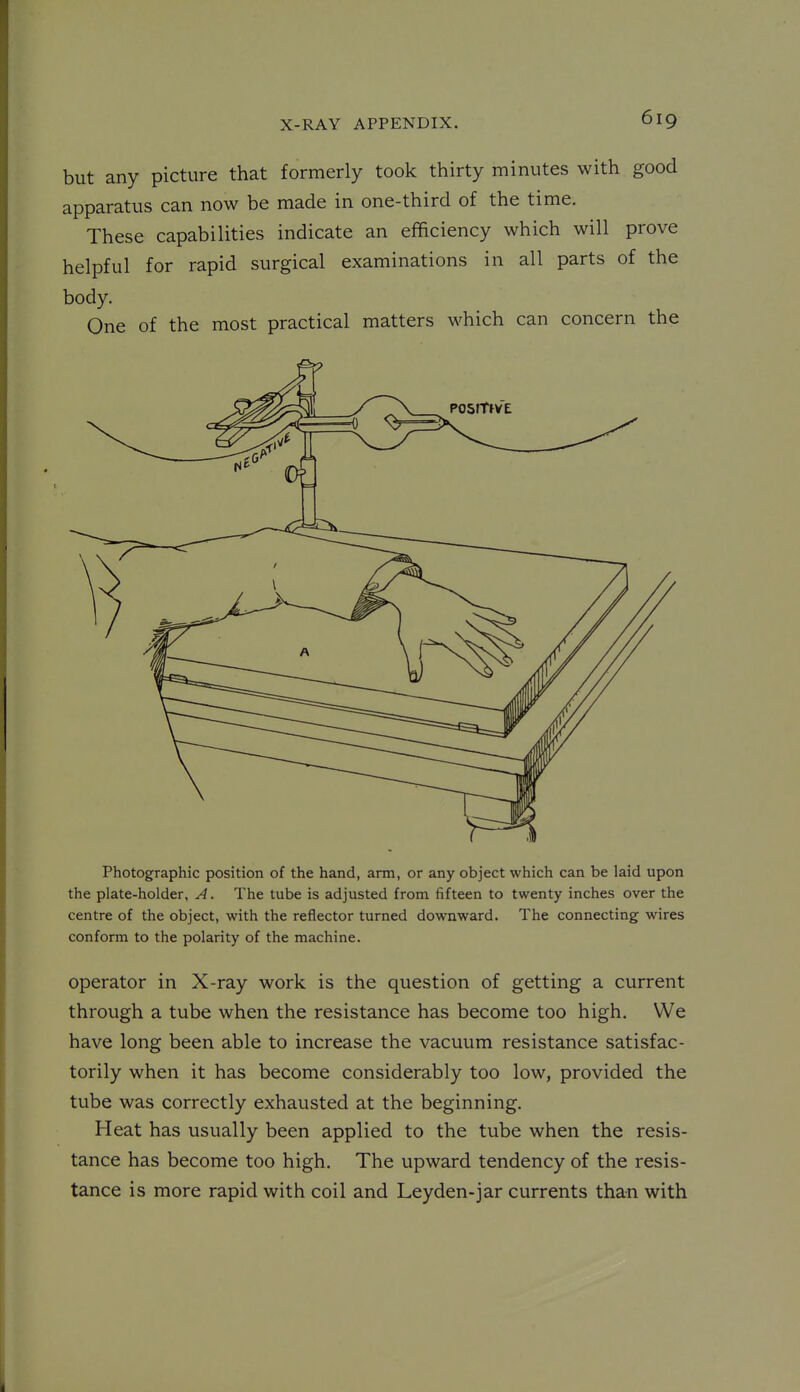 but any picture that formerly took thirty minutes with good apparatus can now be made in one-third of the time. These capabilities indicate an efficiency which will prove helpful for rapid surgical examinations in all parts of the body. One of the most practical matters which can concern the Photographic position of the hand, arm, or any object which can be laid upon the plate-holder, A. The tube is adjusted from fifteen to twenty inches over the centre of the object, with the reflector turned downward. The connecting wires conform to the polarity of the machine. operator in X-ray work is the question of getting a current through a tube when the resistance has become too high. We have long been able to increase the vacuum resistance satisfac- torily when it has become considerably too low, provided the tube was correctly exhausted at the beginning. Heat has usually been applied to the tube when the resis- tance has become too high. The upward tendency of the resis- tance is more rapid with coil and Leyden-jar currents than with