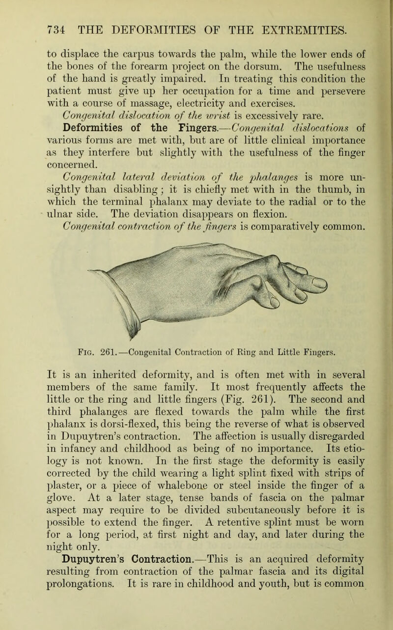 to displace the carpus towards the palm, while the lower ends of the bones of the forearm project on the dorsum. The usefulness of the hand is greatly impaired. In treating this condition the patient must give up her occupation for a time and persevere with a course of massage, electricity and exercises. Congenital dislocation of the wrist is excessively rare. Deformities of the Fingers.—Congenital dislocations of various forms are met with, but are of little clinical importance as they interfere but slightly with the usefulness of the finger concerned. Congenital lateral deviation of the phalanges is more un- sightly than disabling; it is chiefly met with in the thumb, in which the terminal phalanx may deviate to the radial or to the ulnar side. The deviation disappears on flexion. Congenital contraction of the fingers is comparatively common. Fig. 261.—Congenital Contraction of Ring and Little Fingers. It is an inherited deformity, and is often met with in several members of the same family. It most frequently affects the little or the ring and little fingers (Fig. 261). The second and third phalanges are flexed towards the palm while the first phalanx is dorsi-flexed, this being the reverse of what is observed in Dupuytren’s contraction. The affection is usually disregarded in infancy and childhood as being of no importance. Its etio- logy is not known. In the first stage the deformity is easily corrected by the child wearing a light splint fixed with strips of plaster, or a piece of whalebone or steel inside the finger of a glove. At a later stage, tense bands of fascia on the palmar aspect may require to be divided subcutaneously before it is possible to extend the finger. A retentive splint must be worn for a long period, at first night and day, and later during the night only. Dupuytren’s Contraction.—This is an acquired deformity resulting from contraction of the palmar fascia and its digital prolongations. It is rare in childhood and youth, but is common