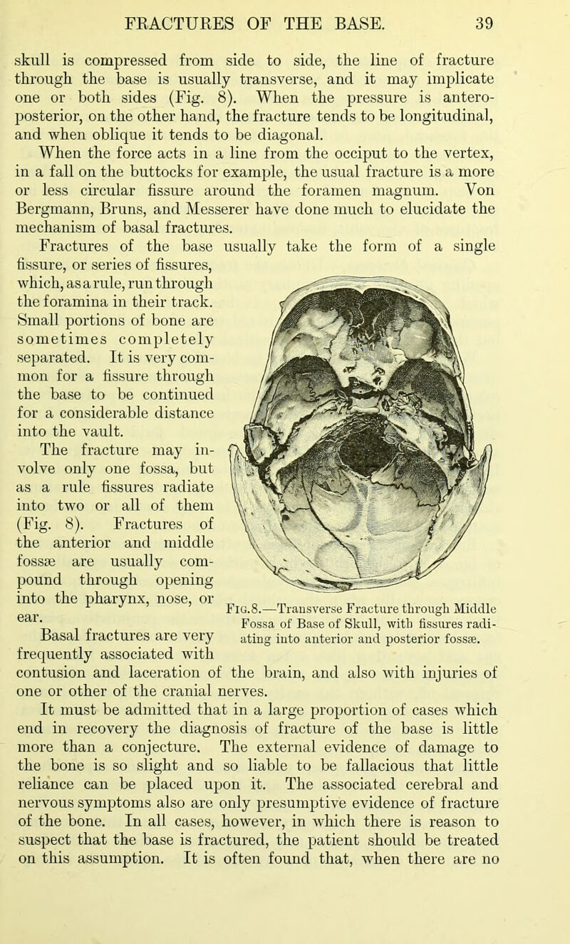 skull is compressed from side to side, the line of fracture through the base is usually transverse, and it may implicate one or both sides (Fig. 8). When the pressure is antero- posterior, on the other hand, the fracture tends to be longitudinal, and when oblique it tends to be diagonal. When the force acts in a line from the occiput to the vertex, in a fall on the buttocks for example, the usual fracture is a more or less circular fissure around the foramen magnum. Von Bergmann, Bruns, and Messerer have done much to elucidate the mechanism of basal fractures. Fractures of the base fissure, or series of fissures, which, as a rule, run through the foramina in their track. Small portions of bone are sometimes completely separated. It is very com- mon for a fissure through the base to be continued for a considerable distance into the vault. The fracture may in- volve only one fossa, but as a rule fissures radiate into two or all of them (Fig. 8). Fractures of the anterior and middle fossae are usually com- pound through opening into the pharynx, nose, or ear. Basal fractures are very frequently associated with contusion and laceration of the brain, and also with injuries of one or other of the cranial nerves. It must be admitted that in a large proportion of cases which end in recovery the diagnosis of fracture of the base is little more than a conjecture. The external evidence of damage to the bone is so slight and so liable to be fallacious that little reliance can be placed upon it. The associated cerebral and nervous symptoms also are only presumptive evidence of fracture of the bone. In all cases, however, in which there is reason to suspect that the base is fractured, the patient should be treated on this assumption. It is often found that, when there are no usually take the form of a single Fig.8.—Transverse Fracture through Middle Fossa of Base of Skull, with fissures radi- ating into anterior and posterior fossse.