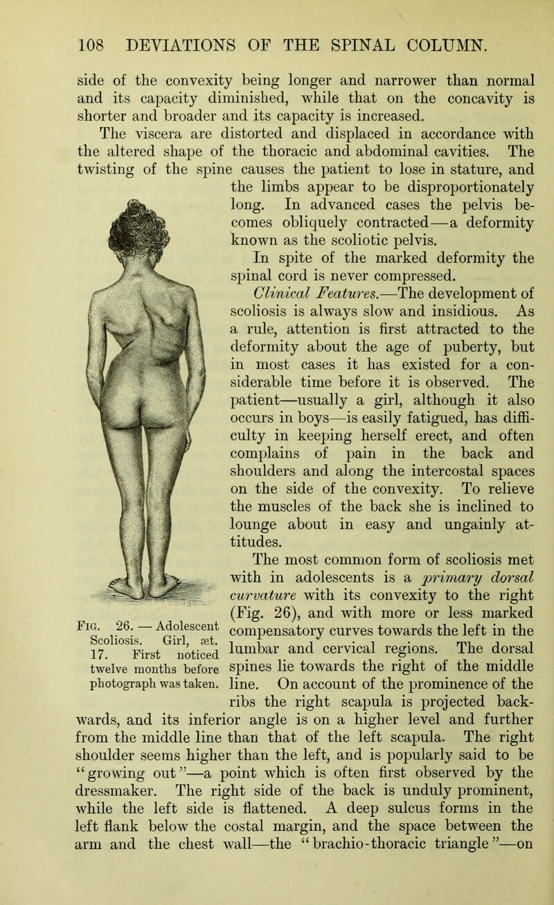 side of the convexity being longer and narrower than normal and its capacity diminished, while that on the concavity is shorter and broader and its capacity is increased. The viscera are distorted and displaced in accordance with the altered shape of the thoracic and abdominal cavities. The twisting of the spine causes the patient to lose in stature, and the limbs appear to be disproportionately long. In advanced cases the pelvis be- comes obliquely contracted—a deformity known as the scoliotic pelvis. In spite of the marked deformity the spinal cord is never compressed. Clinical Features.—The development of scoliosis is always slow and insidious. As a rule, attention is first attracted to the deformity about the age of puberty, but in most cases it has existed for a con- siderable time before it is observed. The patient—usually a girl, although it also occurs in boys—is easily fatigued, has diffi- culty in keeping herself erect, and often complains of pain in the back and shoulders and along the intercostal spaces on the side of the convexity. To relieve the muscles of the back she is inclined to lounge about in easy and ungainly at- titudes. The most common form of scoliosis met with in adolescents is a 'primary dorsal curvature with its convexity to the right (Fig. 26), and with more or less marked ,.26; Adolescent compensatory curves towards the left in the 17 First noticed 111111'jar and cervical regions. The dorsal twelve months before spines lie towards the right of the middle photograph was taken, line. On account of the prominence of the ribs the right scapula is projected back- wards, and its inferior angle is on a higher level and further from the middle line than that of the left scapula. The right shoulder seems higher than the left, and is popularly said to be “growing out”—a point which is often first observed by the dressmaker. The right side of the back is unduly prominent, while the left side is flattened. A deep sulcus forms in the left flank below the costal margin, and the space between the arm and the chest wall—the “brachio-thoracic triangle”—on