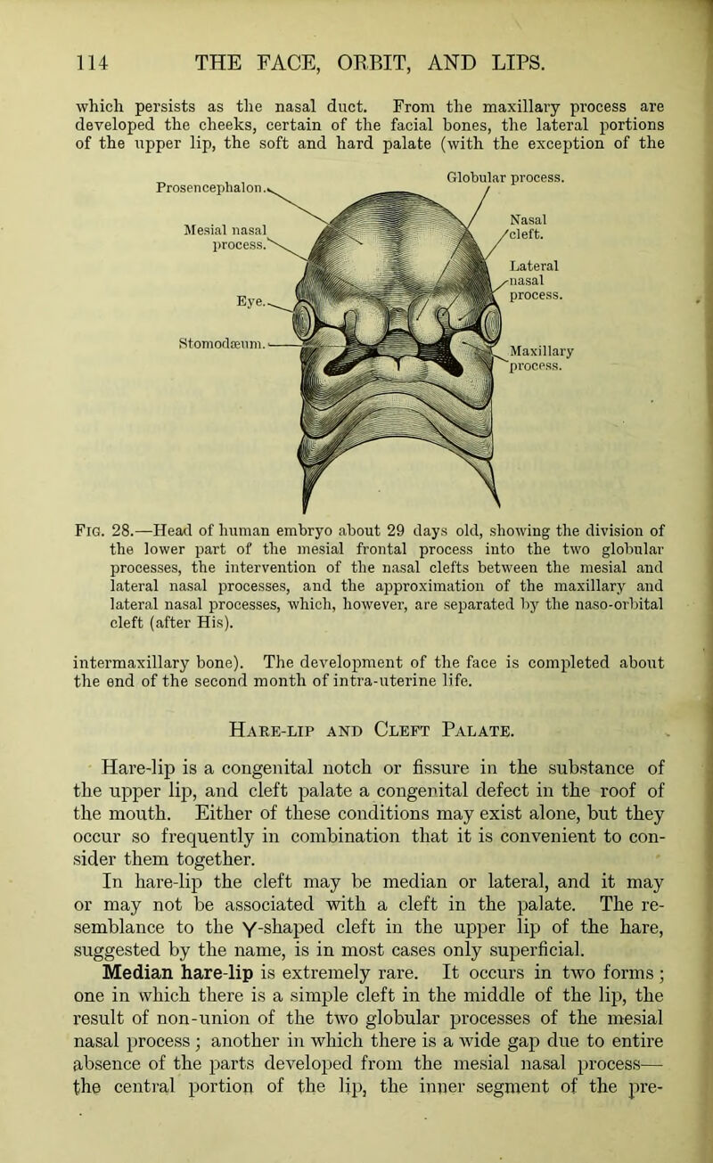 which persists as the nasal duct. From the maxillary process are developed the cheeks, certain of the facial bones, the lateral portions of the upper lip, the soft and hard palate (with the exception of the Prosencephalon Mesial nasal process. Stomod Eeum. Globular process. Nasal Lateral process Maxillary process. Fig. 28.—Head of human embryo about 29 days old, showing the division of the lower part of the mesial frontal process into the two globular processes, the intervention of the nasal clefts between the mesial and lateral nasal processes, and the approximation of the maxillary and lateral nasal processes, which, however, are separated by the naso-orbital cleft (after His). intermaxillary bone). The development of the face is completed about the end of the second month of intra-uterine life. Hare-lip and Cleft Palate. Hare-lip is a congenital notch or fissure in the substance of the upper lip, and cleft palate a congenital defect in the roof of the mouth. Either of these conditions may exist alone, but they occur so frequently in combination that it is convenient to con- sider them together. In hare-lip the cleft may be median or lateral, and it may or may not be associated with a cleft in the palate. The re- semblance to the Y-shaped cleft in the upper lip of the hare, suggested by the name, is in most cases only superficial. Median hare-lip is extremely rare. It occurs in two forms; one in which there is a simple cleft in the middle of the lip, the result of non-union of the two globular processes of the mesial nasal process ; another in which there is a wide gap due to entire absence of the parts developed from the mesial nasal process— the central portion of the lip, the inner segment of the pre-