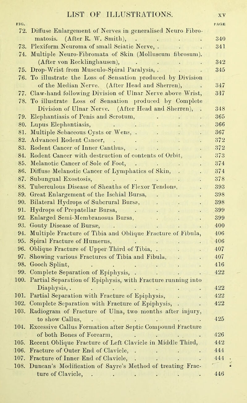FIG. PAGE 72. Diffuse Enlargement of Nerve.s in generalised Neuro Fibro- matosis. (After K. W. Sniitli), .... 340 73. Plexiform Neuroma of small Sciatic Nerve, . . . 341 74. Multiple Neuro-Fibromata of Skin (Molluscum fibrosum). (After von Recklinghausen), . . . .342 75. Drop-Wrist from Musculo-Sjiiral Paralysis, . . . 345 76. To illustrate the Loss of Sensation produced by Division of the Median Nerve. (After Head and Sherren), . 347 77. Claw-hand following Division of Ulnar Nerve above Wrist, 347 78. To illustrate Loss of Sensation produced by Complete Division of Ulnar Nerve. (After Head and Sherren), . 348 79. Elephantiasis of Penis and Scrotum, . . . 365 80. Lupus Elephantiasis, ..... 366 81. Multiple Sebaceous Cysts or Wens, .... 367 82. Advanced Rodent Cancer, . . . . .372 83. Rodent Cancer of Inner Canthus, .... 372 84. Rodent Cancer with destruction of contents of Orbit, . 373 85. Melanotic Cancer of Sole of Foot, .... 374 86. Diffuse Melanotic Cancer of Lymphatics of Skin, . . 374 87. Subungual Exostosis, ..... 378 88. Tuberculous Disease of Sheaths of Flexor Tendon., . 393 89. Great Enlargement of the Ischial Bursa, . . . 398 90. Bilateral Hydrops of Subcrural Bursa, . . . 398 91. Hydrops of Prepatellar Bursa, .... 399 92. Enlarged Semi-Membranosus Bursa, . . . 399 93. Gouty Disease of Bursas, ..... 400 94. Multiple Fracture of Tibia and Oblique Fracture of Fibula, 406 95. Spiral Fracture of Humerus, .... 406 96. Oblique Fracture of Upper Third of Tibia, . . . 407 97. Showing various Fractures of Tibia and Fibula, . . 407 98. Gooch Splint, ...... 416 99. Complete Separation of Epiphysis, .... 422 100. Partial Separation of Epiphysis, with Fracture running into Diaphysis, ....... 422 101. Partial Separation with Fracture of Epiphysis, . . 422 102. Complete Separation with Fracture of Epiphysis, . . 422 103. Radiogram of Fracture of Ulna, two months after injury, to show Callus, ...... 425 104. Flxcessive Callus Formation after Septic Compound Fracture of both Bones of Forearm, . . . .426 105. Recent Oblique Fracture of Left Clavicle in Middle Third, 442 106. Fracture of Outer End of Clavicle, .... 444 107. Fracture of Inner End of Clavicle, .... 444 108. Duncan’s Modification of Sayre’s Method of treating Frac- ture of Clavicle, ...... 446