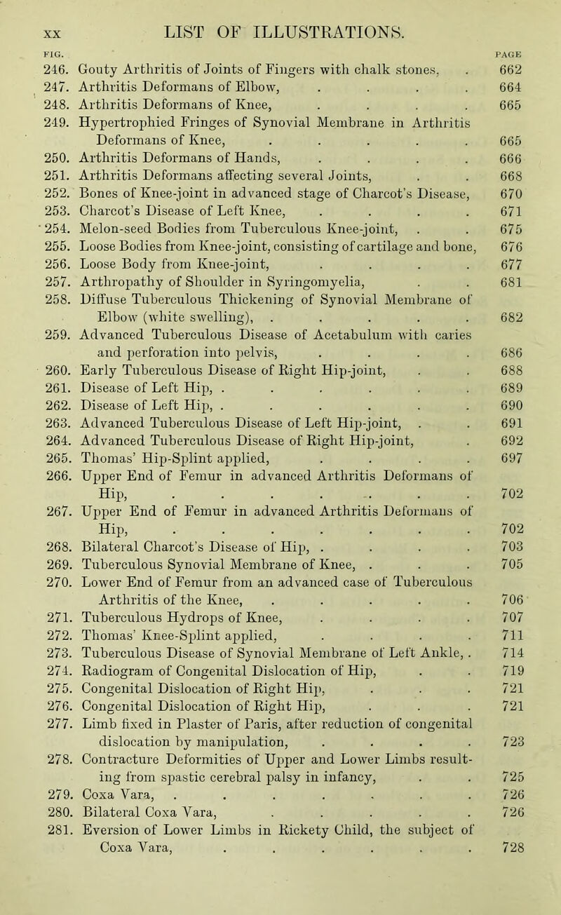 FIG. PAGE 246. Gouty Arthritis of Joints of Fingers with chalk stone.s, . 662 247. Arthritis Deformans of Elbow, .... 664 248. Arthritis Deformans of Knee, .... 665 249. Hypertrophied Fringes of Synovial Membrane in Arthritis Deformans of Knee, ..... 665 250. Arthritis Deformans of Hands, . . . .666 251. Arthritis Deformans affecting several Joints, . . 668 252. Bones of Knee-joint in advanced stage of Charcot’s Disease, 670 253. Charcot’s Disease of Left Knee, . . . .671 ■ 254. Melon-seed Bodies from Tuberculous Knee-joint, . . 675 255. Loose Bodies from Knee-joint, con.sisting of cartilage and bone, 676 256. Loose Body from Knee-joint, .... 677 257. Arthropathy of Shoulder in Syringomyelia, . . 681 258. Diffuse Tuberculous Thickening of Synovial Membrane of Elbow (white swelling), ..... 682 259. Advanced Tuberculous Disease of Acetabulum with caries and perforation into 23elvis, .... 686 260. Early Tuberculous Disease of Right Hip-joint, . . 688 261. Disease of Left Hip, ...... 689 262. Disease of Left Hijt, ...... 690 263. Advanced Tuberculous Disease of Left Hip-joint, . . 691 264. Advanced Tuberculous Disease of Right Hip-joint, . 692 265. Thomas’ Hip-Splint applied, .... 697 266. Ufjper End of Femur in advanced Arthritis Deformans of Hij), . . . . -. . .702 267. Upper End of Femur in advanced Arthritis Deformans of Hip, ....... 702 268. Bilateral Charcot’s Disease of Hij), .... 703 269. Tuberculous Synovial Membrane of Knee, . . .705 270. Lower End of Femur from an advanced case of Tuberculous Arthritis of the Knee, . . . . .706 271. Tuberculous Hydrops of Knee, .... 707 272. Thomas’ Knee-Sp)lint applied, .... 711 273. Tuberculous Disease of Synovial Membrane of Left Ankle,. 714 274. Radiogram of Congenital Dislocation of Hip, . . 719 275. Congenital Dislocation of Right Hip, . . .721 276. Congenital Dislocation of Right Hip, . . . 721 277. Limb fixed in Plaster of Paris, after reduction of congenital dislocation by mani^nilation, .... 723 278. Contracture Deformities of Upper and Lower Limbs result- ing from spastic cerebral palsy in infancy, . . 725 279. Coxa Vara, . . . . . . .726 280. Bilateral Coxa Vara, . . . . .726 281. Eversion of Lower Limbs in Rickety Child, the subject of Coxa Vara, ...... 728