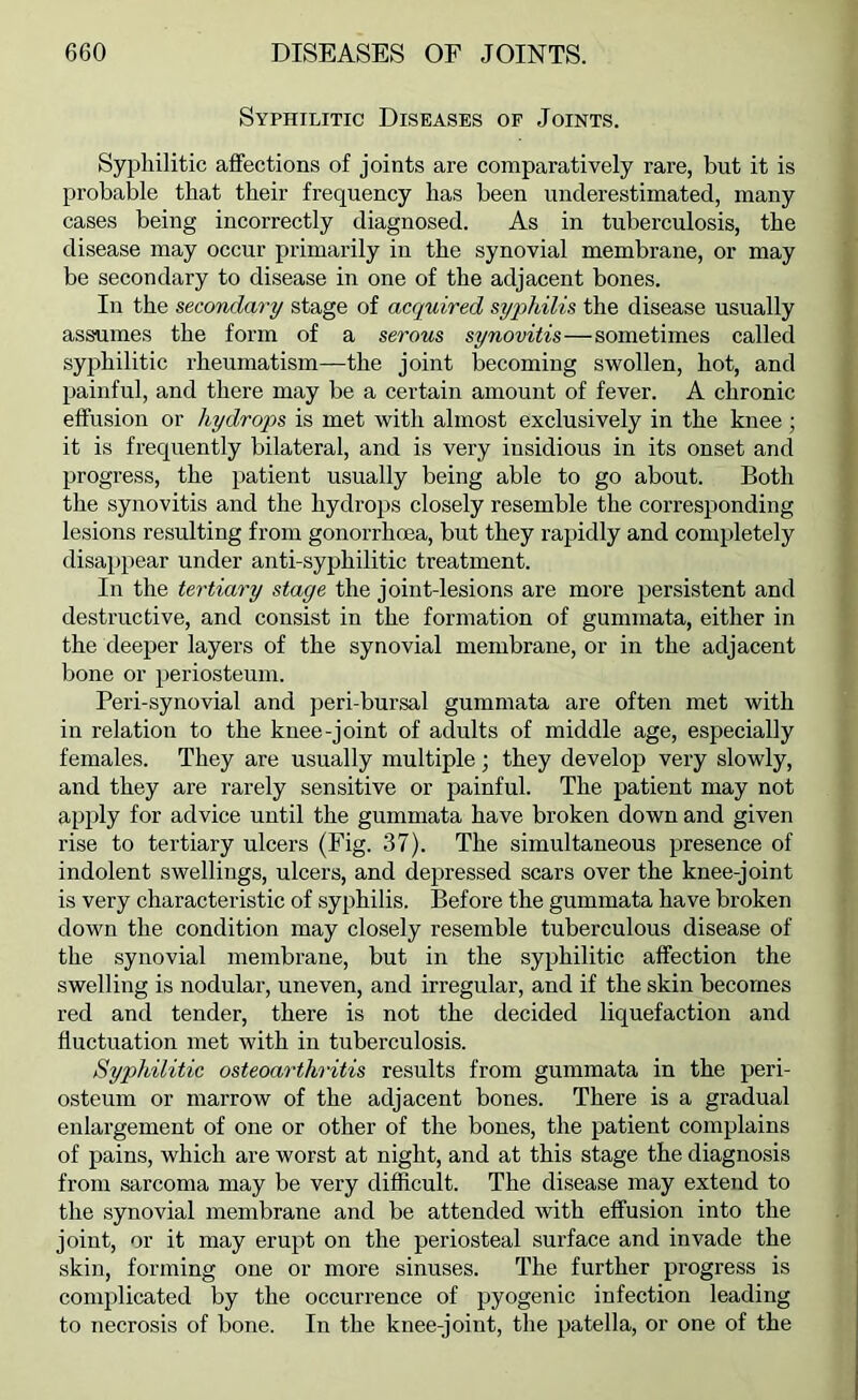 Syphilitic Diseases of Joints. Syphilitic affections of joints are comparatively rare, but it is probable that their frequency has been underestimated, many cases being incorrectly diagnosed. As in tuberculosis, the disease may occur primarily in the synovial membrane, or may be secondary to disease in one of the adjacent bones. In the secondary stage of acquired syqqhilis the disease usually assumes the form of a serous synovitis—sometimes called syphilitic rheumatism—the joint becoming swollen, hot, and painful, and there may be a certain amount of fever. A chronic effusion or hydrops is met with almost exclusively in the knee; it is frequently bilateral, and is very insidious in its onset and progress, the patient usually being able to go about. Both the synovitis and the hydrops closely resemble the corresponding lesions resulting from gonorrhoea, but they rapidly and completely disappear under anti-syphilitic treatment. In the tertiary stage the joint-lesions are more persistent and destructive, and consist in the formation of gummata, either in the deeper layers of the synovial membrane, or in the adjacent bone or periosteum. Peri-synovial and peri-bursal gummata are often met with in relation to the knee-joint of adults of middle age, especially females. They are usually multiple; they develop very slowly, and they are rarely sensitive or painful. The patient may not apply for advice until the gummata have broken down and given rise to tertiary ulcers (Fig. 37). The simultaneous presence of indolent swellings, ulcers, and depressed scars over the knee-joint is very characteristic of syphilis. Before the gummata have broken down the condition may closely resemble tuberculous disease of the synovial membrane, but in the syphilitic affection the swelling is nodular, uneven, and irregular, and if the skin becomes red and tender, there is not the decided liquefaction and fluctuation met with in tuberculosis. Syphilitic osteoarthritis results from gummata in the peri- osteum or marrow of the adjacent bones. There is a gradual enlargement of one or other of the bones, the patient complains of pains, which are worst at night, and at this stage the diagnosis from sarcoma may be very difficult. The disease may extend to the synovial membrane and be attended with effusion into the joint, or it may erupt on the periosteal surface and invade the skin, forming one or more sinuses. The further progress is com^ilicated by the occurrence of pyogenic infection leading to necrosis of bone. In the knee-joint, the patella, or one of the