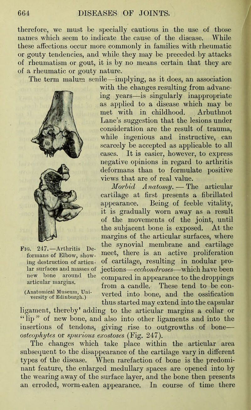 tlierefore, we must be specially cautious in the use of those names which seem to indicate the cause of the disease. While these affections occur more commonly in families with rheumatic or gouty tendencies, and while they may be preceded by attacks of rheumatism or gout, it is by no means certain that they are of a rheumatic or gouty nature. The term malum senile—implying, as it does, an association with the changes resulting from advanc- ing years—is singularly inappropriate as applied to a disease which may be met with in childhood. Arbuthnot Lane’s suggestion that the lesions under consideration are the result of trauma, while ingenious and instructive, can scarcely be accepted as applicable to all cases. It is easier, however, to express negative opinions in regard to arthritis deformans than to formulate positive views that are of real value. Morbid Anatomy. — The articular cartilage at first presents a fibrillated appearance. Being of feeble vitality, it is gradually worn away as a result of the movements of the joint, until the subjacent bone is exposed. At the margins of the articular surfaces, where the synovial membrane and cartilage meet, there is an active proliferation of cartilage, resulting in nodular pro- jections—ecchondroses—which have been compared in appearance to the droppings from a candle. These tend to be con- verted into bone, and the ossification thus started may extend into the capsular ligament, thereby' adding to the articular margins a collar or “lip” of new bone, and also into other ligaments and into the insertions of tendons, giving rise to outgrowths of bone— osteoiiliytes or spurious exostoses (Fig. 247). The changes which take place within the articular area subsequent to the disajjpearance of the cartilage vary in different types of the disease. When rarefaction of bone is the predomi- nant feature, the enlarged medullary spaces are opened into by the wearing away of the surface layer, and the bone then presents an erroded, worm-eaten appearance. In course of time there Fio. 247.—Arthritis De- formans of Elbow, show- ing destruction of articu- lar surfaces and masses of new hone around the articular margins. (Anatomical Museum, Uni- versity of Edinburgh.)