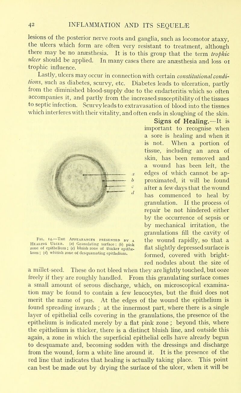 lesions of the posterior nerve roots and ganglia, such as locomotor ataxy, the ulcers which form are often very resistant to treatment, although there may be no anaesthesia. It is to this group that the term trophic ulcer should be applied. In many cases there are anaesthesia and loss ol trophic influence. Lastly, ulcers may occur in connection with certain constitutional condi- tions, such as diabetes, scurvy, etc. Diabetes leads to ulceration, partly from the diminished blood-supply due to the endarteritis which so often accompanies it, and partly from the increasedsusceptibility of the tissues to septic infection. Scurvy leads to extravasation of blood into the tissues which interferes with their vitality, and often ends in sloughing of the skin. Signs of Healing.—It is important to recognise when a sore is healing and when it is not. When a portion of tissue, including an area of skin, has been removed and a wound has been left, the '„ m „ ., . a edges of which cannot be ap- *^— b proximated, it will be found ~ ^ after a few days that the wound > has commenced to heal by ^^^Ikkm^* • granulation. If the process of repair be not hindered either by the occurrence of sepsis or by mechanical irritation, the granulations fill the cavity of Fig. 14.—The Appearances presented by a the WOUud rapidly, SO that a Healing Ulcer. [a) Granulating surface: (b) pink n , t 1 1 t 1 r zone of epithelium ; [c) bluish zone of thiclier epithe- uat Silghtly depressed SUrtaCC IS hum; M whitish zone of desquamating epithelium. iormtd, COVCrcd with bright- red nodules about the size of a millet-seed. These do not bleed when they are lightly touched, but ooze freely if they are roughly handled. From this granulating surface comes a small amount of serous discharge, which, on microscopical examina- tion may be found to contain a few leucocytes, but the fluid does not merit the name of pus. At the edges of the wound the epithelium is found spreading inwards ; at the innermost part, where there is a single layer of epithelial cells covering in the granulations, the presence of the epithelium is indicated merely by a flat pink zone; beyond this, where the epithelium is thicker, there is a distinct bluish line, and outside this again, a zone in which the superficial epithelial cells have already begun to desquamate and, becoming sodden with the dressings and discharge from the wound, form a white line around it. It is the presence of the red hne that indicates that healing is actually taking place. This point can best be made out by drying the surface of the ulcer, when it will be