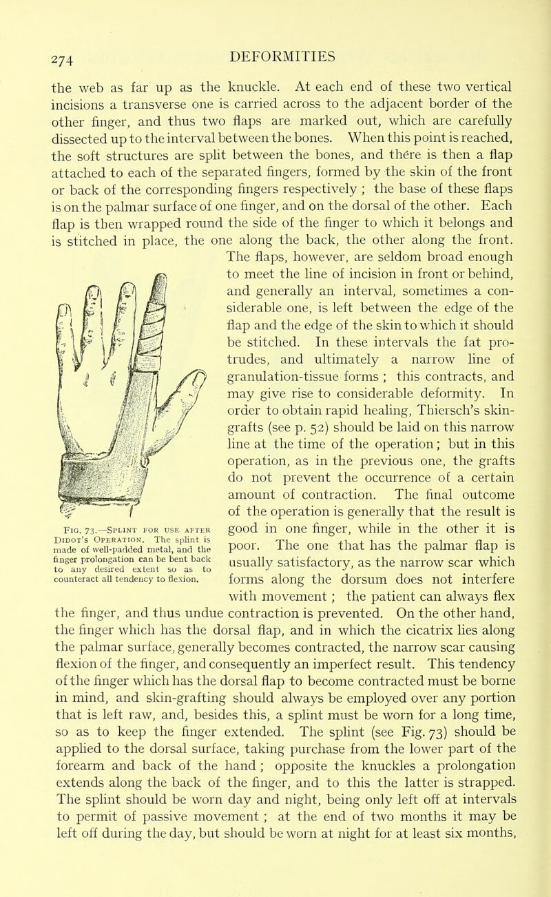 the web as far up as the knuckle. At each end of these two vertical incisions a transverse one is carried across to the adjacent border of the other finger, and thus two flaps are marked out, which are carefully dissected up to the interval between the bones. When this point is reached, the soft structures are split between the bones, and there is then a flap attached to each of the separated fingers, formed by the skin of the front or back of the corresponding fingers respectively ; the base of these flaps is on the palmar surface of one finger, and on the dorsal of the other. Each flap is then wrapped round the side of the finger to which it belongs and is stitched in place, the one along the back, the other along the front. The flaps, however, are seldom broad enough to meet the line of incision in front or behind, and generally an interval, sometimes a con- siderable one, is left between the edge of the flap and the edge of the skin to which it should be stitched. In these intervals the fat pro- trudes, and ultimately a narrow line of granulation-tissue forms ; this contracts, and may give rise to considerable deformity. In order to obtain rapid healing, Thiersch's skin- grafts (see p. 52) should be laid on this narrow line at the time of the operation; but in this operation, as in the previous one, the grafts do not prevent the occurrence of a certain amount of contraction. The final outcome of the operation is generally that the result is good in one finger, while in the other it is poor. The one that has the palmar flap is usually satisfactory, as the narrow scar which forms along the dorsum does not interfere with movement ; the patient can always flex the finger, and thus undue contraction is prevented. On the other hand, the finger which has the dorsal flap, and in which the cicatrix lies along the palmar surface, generally becomes contracted, the narrow scar causing flexion of the finger, and consequently an imperfect result. This tendency of the finger which has the dorsal flap to become contracted must be borne in mind, and skin-grafting should always be employed over any portion that is left raw, and, besides this, a sphnt must be worn for a long time, so as to keep the finger extended. The sphnt (see Fig. 73) should be applied to the dorsal surface, taking purchase from the lower part of the forearm and back of the hand ; opposite the knucldes a prolongation extends along the back of the finger, and to this the latter is strapped. The splint should be worn day and night, being only left off at intervals to permit of passive movement; at the end of two months it may be left off during the day, hnt should be worn at night for at least six months. Fig. 73.—Splint for use after Didot's Operation. The splint is made of well-padded metal, and the finger prolougatiou can be bent back to any desired extent so as to counteract all tendency to flexion.