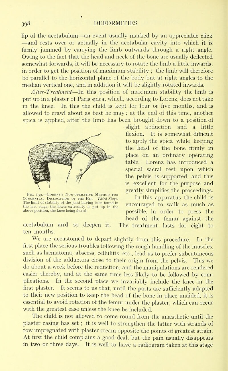 lip of the acetabulum—an event usually marked by an appreciable click —and rests over or actually in the acetabular cavity into which it is firmly jammed by carrying the limb outwards through a right angle. Owing to the fact that the head and neck of the bone are usually deflected somewhat forwards, it will be necessary to rotate the hmb a little inwards, in order to get the position of maximum stability ; the limb will therefore be parallel to the horizontal plane of the body but at right angles to the median vertical one, and in addition it will be slightly rotated inwards. After-Treatment—In this position of maximum stability the hmb is put up in a plaster of Paris spica, which, according to Lorenz, does not take in the knee. In this the child is kept for four or five months, and is allowed to crawl about as best he may; at the end of this time, another spica is applied, after the limb has been brought down to a position of acetabulum and so deepen it. The treatment lasts for eight to ten months. We are accustomed to depart slightly from this procedure. In the first place the serious troubles following the rough handUng of the muscles, such as hc-ematoma, abscess, cellulitis, etc., lead us to prefer subcutaneous division of the adductors close to their origin from the pelvis. This we do about a week before the reduction, and the manipulations are rendered easier thereby, and at the same time less likely to be followed by com- plications. In the second place we invariably include the knee in the first plaster. It seems to us that, until the parts are sufficiently adapted to their new position to keep the head of the bone in place unaided, it is essential to avoid rotation of the femur under the plaster, which can occur with the greatest ease unless the knee be included. The child is not allowed to come round from the anaesthetic until the plaster casing has set; it is well to strengthen the latter with strands of tow impregnated with plaster cream opposite the points of greatest strain. At first the child complains a good deal, but the pain usually disappears in two or three days. It is well to have a radiogram taken at this stage Fig. 139.—LoRENz's Non-operative Method for Congenital Dislocation of the Hip. Third Stage. The limit of stability of the joint having been found in the last stage, the lower extremity is put up in the above position, the knee being flexed. slight abduction and a little flexion. It is somewhat difficult to apply the spica while keeping the head of the bone firmly in place on an ordinary operating table. Lorenz has introduced a special sacral rest upon which the pelvis is supported, and this is excellent for the purpose and greatly simplifies the proceedings. In this apparatus the child is encouraged to walk as much as possible, in order to press the head of the femur against the