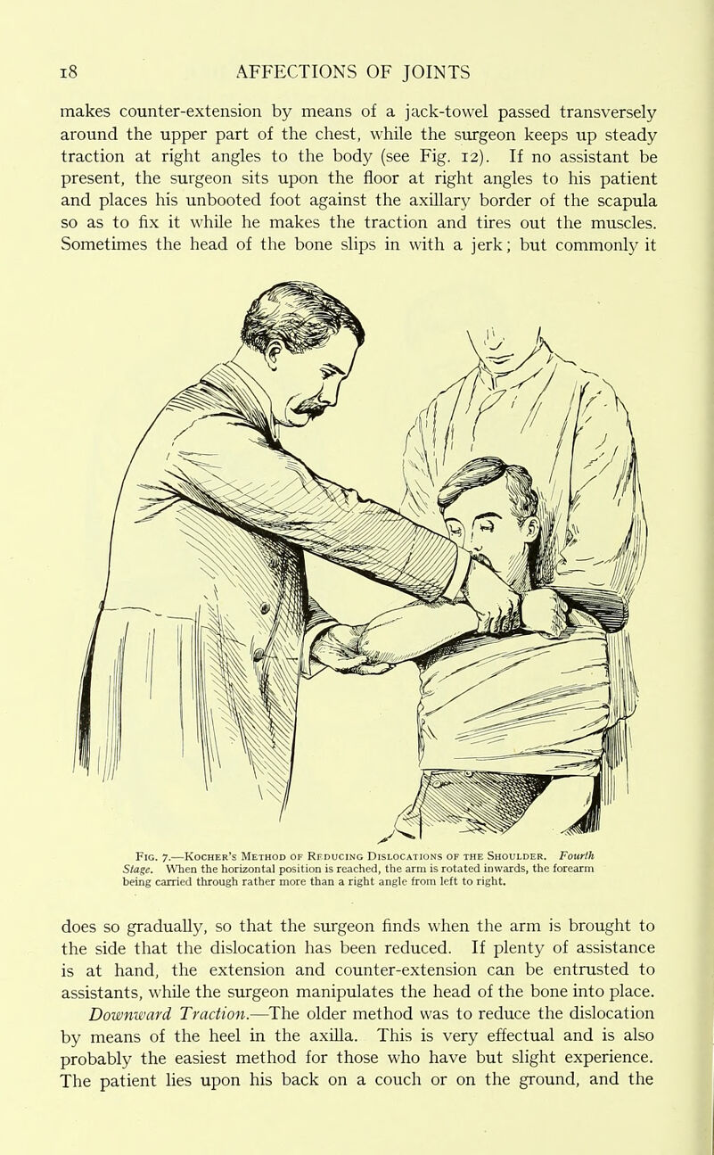 makes counter-extension by means of a jack-towel passed transversely around the upper part of the chest, while the surgeon keeps up steady traction at right angles to the body (see Fig. 12). If no assistant be present, the surgeon sits upon the floor at right angles to his patient and places his unbooted foot against the axillary border of the scapula so as to fix it while he makes the traction and tires out the muscles. Sometimes the head of the bone slips in with a jerk; but commonly it Fig. 7.—Kocher's Method of Rfducing Dislocations of the Shoulder. Fourth Stage. When the horizontal position is reached, the arm is rotated inwards, the forearm being carried through rather more than a right angle from left to right. does so gradually, so that the surgeon finds when the arm is brought to the side that the dislocation has been reduced. If plenty of assistance is at hand, the extension and counter-extension can be entrusted to assistants, while the surgeon manipidates the head of the bone into place. Downward Tractio7i.—The older method was to reduce the dislocation by means of the heel in the axUla. This is very effectual and is also probably the easiest method for those who have but slight experience. The patient lies upon his back on a couch or on the ground, and the