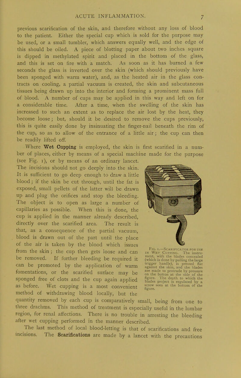 previous scarification of the skin, and therefore without any loss of blood to the patient. Either the special cup which is sold for the purpose may be used, or a small tumbler, which answers equally well, and the edge of this should be oiled. A piece of blotting paper about two inches square is dipped in methylated spirit and placed in the bottom of the glass, and this is set on fire with a match. As soon as it has burned a few seconds the glass is inverted over the skin (which should previously have been sponged with warm water), and, as the heated air in the glass con- tracts on cooling, a partial vacuum is created, the skin and subcutaneous tissues being drawn up into the interior and forming a prominent mass full of blood. A number of cups may be applied in this way and left on for a considerable time. After a time, when the swelling of the skin has increased to such an extent as to replace the air lost by the heat, they become loose; but, should it be desired to remove the cups previously, this is quite easily done by insinuating the finger-nail beneath the rim of the cup, so as to allow of the entrance of a little air; the cup can then be readily lifted off. Where Wet Cupping is employed, the skin is first scarified in a num- ber of places, either by means of a special machine made for the purpose (see Fig. i), or by means of an ordinary lancet. The incisions should not go deeply into the skin. It is sufficient to go deep enough to draw a little blood; if the skin be cut through, until the fat is e.xposed, small pellets of the latter will be drawn up and plug the orifices and stop the bleeding. The object is to open as large a number of capillaries as possible. When this is done, the cup is applied in the manner already described, directly over the scarified area. The result is that, as a consequence of the partial vacuum, blood is drawn out of the part until the place of the air is taken by the blood which issues from the skin ; the cup then gets loose and can be removed. If further bleeding be required it can be promoted by the application of warm fomentations, or the scarified surface may be sponged free of clots and the cup again applied as before. Wet cupping is a most convenient method of withdrawing blood locally, but the quantity removed by each cup is comparatively small, being from one to three drachms. This method of treatment is especially useful in the lumbar region, for renal affections. There is no trouble in arresting the bleeding after wet cupping performed in the manner described. The last method of local blood-letting is that of scarifications and free incisions. The Scarifications are made by a lancet with the precautions Fig. I.—Scarificator for use IN Wet Cui'i'iNG. The instru- ment, with the hl.ide-; concealed (which is done by pulling the large trigger handle),' is pressed flat .ngainst the skin, and the blades are made to protrude by pressure on the button at the side of the figure. Tile depth to which the blades project is regulated by a screw seen at the bottom of the figure.