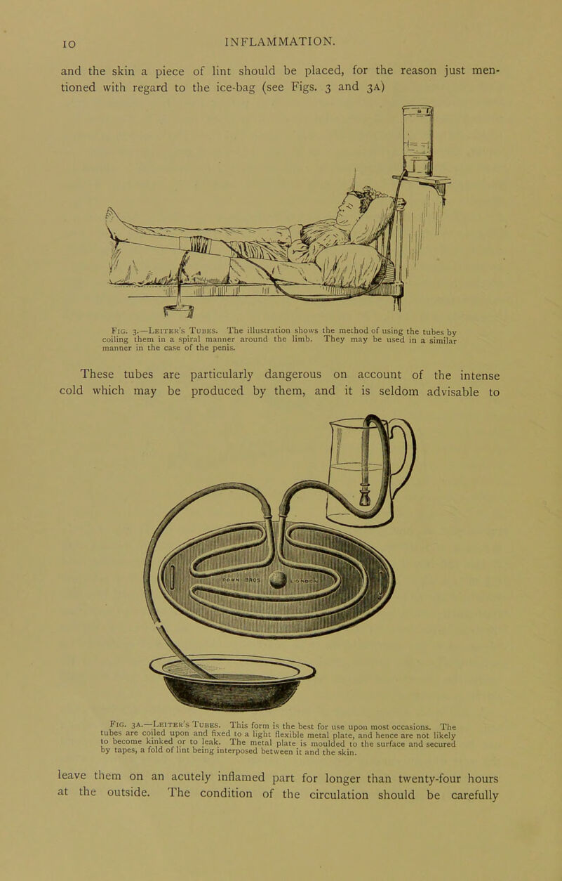 and the skin a piece of lint should be placed, for the reason just men tioned with regard to the ice-bag (see Figs. 3 and 3A) Fig. 3.—Letter's Tuues. The illustration shows the method of using the tubes by coiling them in a spiral manner around the limb. They may be used in a similar manner in the case of the penis. These tubes are particularly dangerous on account of the intense cold which may be produced by them, and it is seldom advisable to Fig. 3A.—Leiter s Tubes. This form is the best for use upon most occasions. The tubes are coiled upon and fi.\ed to a light flexible metal plate, and hence are not likely to become kinked or to le.ik. The metal plate is moulded to the surface and secured by tapes, a fold of Imt bemg interposed between it and the skin. leave them on an acutely inflamed part for longer than twenty-four hours at the outside. The condition of the circulation should be carefully
