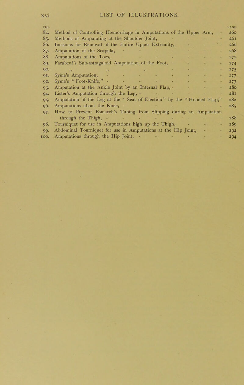 KIG. 84. Method of Controlling Haemorrhage in Amputations of the Upper Arm, PAGE 260 Methods of Amputating at the Shoulder Joint, .... 261 86. Incisions for Removal of the Entire Upper Extremity, 266 87. Amputation of the Scapula, 268 88. Amputations of the Toes, 272 89. Farabeuf's Sub-astragaloid Amputation of the Foot, - - - . 274 90. 275 91- Syme's Amputation, 277 92. Syme's Foot-Knife, ------- 277 93- Amputation at the Ankle Joint by an Internal Flap, - - - - 280 94- Lister's Amputation through the Leg, ------ 281 95- Amputation of the Leg at the Seat of Election by the Hooded Flap, 282 96. Amputations about the Knee, ------- 285 97- How to Prevent Esmarch's Tubing from Slipping during an Amputation through the Thigh, -------- 288 98. Tourniquet for use in Amputations high up the Thigh, 289 99- Abdominal Tourniquet for use in Amputations at the Hip Joint, 292 100. Amputations through the Hip Joint, 294