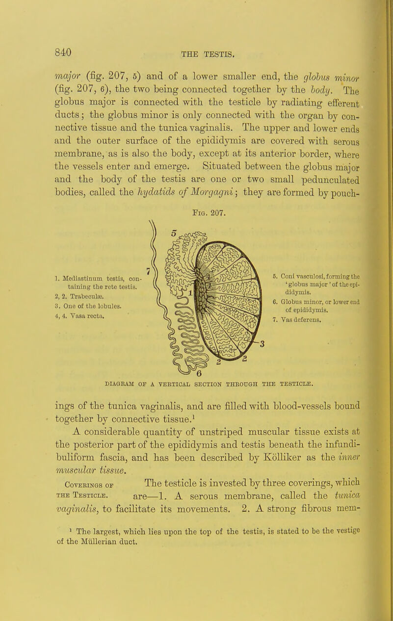 major (fig. 207, 5) and of a lower smaller end, the globus minor (fig. 207, 6), the two being connected together by the body. The globus major is connected with the testicle by radiating efferent ducts; the globus minor is only connected with the organ by con- nective tissue and the tunica vaginalis. The upper and lower ends and the outer surface of the epididymis are covered with serous membrane, as is also the body, except at its anterior border, where the vessels enter and emerge. Situated between the globus major and the body of the testis are one or two small pedunculated bodies, called the hydatids of Morgagni; they are formed by pouch- FiG. 207. 1. Mediastinum testis, con- taining the rete testis. 2. 2. Trabeoulse. 3. One of the lobules. i, i. Vasa recta. 5. Coni vascnlosi, fonning the ' globus major' o£ the epi- didymis. 6. Globus minor, or lower end of epididymis. 7. Vas deferens. DIAGRAM OF A VEETICAL SECTION THEODGH THE TESTICLE. ings of the tunica vaginalis, and are filled wdth blood-vessels bound together by connective tissue.^ A considerable quantity of unstriped muscular tissue exists at the posterior part of the epididymis and testis beneath the infundi- buliform fascia, and has been described by KoUiker as the inner muscula/r tissue. CovEBiNGs OF The tcsticlo is invested by three coverings, which THE Testicle. are—1. A serous membrane, called the tunica vaginalis, to facilitate its movements. 2. A strong fibrous mem- > The largest, -which lies upon the top of the testis, is stated to be the vestige of the Miillerian duct.