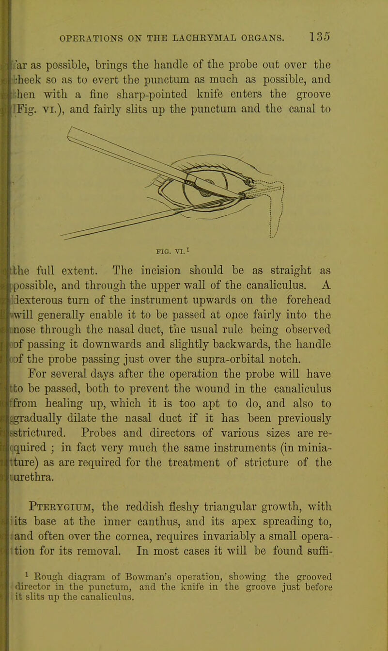 ar as possible, brings the handle of the probe out over the lieek so as to evert the pnnctum as much as possible, and hen with a fine sharp-pointed knife enters the groove Fig. VI.), and fairly slits up the punctum and the canal to FIG. VI. 1 he full extent. The incision should be as straight as lossible, and through the upper wall of the canaliculus. A iexterous turn of the instrument upwards on the forehead will generally enable it to be passed at once fairly into the nose through the nasal duct, the usual rule being observed )f passing it downwards and slightly backwards, the handle )f the probe passing just over the supra-orbital notch. For several days after the operation the probe will have :o be passed, both to prevent the wound in the canaliculus I'rom healing up, which it is too apt to do, and also to i^^radually dilate the nasal duct if it has been previously strictured. Probes and directors of various sizes are re- [uired ; in fact very much the same instruments (in minia- ture) as are required for the treatment of stricture of the urethra. Pterygium, the reddish fleshy triangular growth, with its base at the inner canthus, and its apex spreading to, and often over the cornea, requires invariably a small opera- tion for its removal. In most cases it will be found suffi- 1 Roii^h diagram of Bowman's operation, shoM'ing the grooved lirectnr in the pnnctum, and the knife in the groove just before i t slits up the canaliculus.