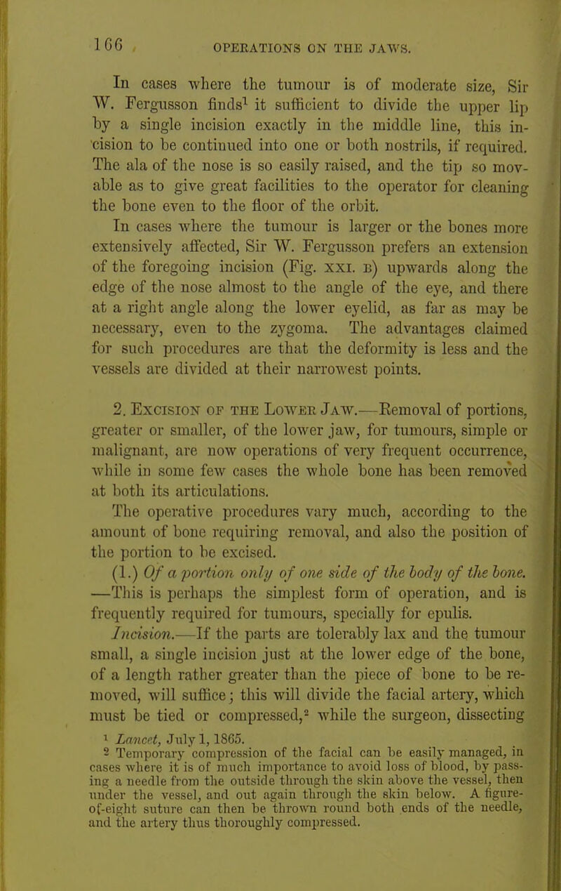 1G6 In cases where the tumour is of moderate size, Sir W, Fergusson finds^ it sufficient to divide the upper lip by a single incision exactly in tlie middle line, this in- cision to be continued into one or both nostrils, if required. The ala of the nose is so easily raised, and the tip so mov- able as to give great facilities to the operator for cleaning the bone even to the floor of the orbit. In cases Avhere the tumour is larger or the bones more extensively affected, Sir W. Fergusson prefers an extension of the foregoing incision (Fig. xxi. b) upwards along the edge of the nose almost to the angle of the eye, and there at a riglit angle along the lower eyelid, as far as may be necessary, even to the zygoma. The advantages claimed for such procedures are that the deformity is less and the vessels are divided at their narrowest points. 2. Excision of the Lowee Jaw.—Removal of portions, greater or smaller, of the lower jaw, for tumours, simple or malignant, are now operations of very frequent occurrence, while in some few cases the whole bone has been removed at both its articulations. The operative procedures vary much, according to the amount of bone requiring removal, and also the position of the portion to be excised. (1.) Of a portion only of one side of the body of the hone. —Tliis is perhaps the simplest form of operation, and is frequently required for tumours, specially for epulis. Incision.—If the parts are tolerably lax and the tumour small, a single incision just at the lower edge of the bone, of a length rather greater than the piece of bone to be re- moved, will suffice; this will divide the facial artery, which must be tied or compressed, Avhile the surgeon, dissecting ^ Lancet, Jnly 1,1865. 2 Temporarj' compression of the facial can be easily managed, in cases where it is of much importance to avoid loss of blood, by pass- ing a needle from the ontside through the skin above the vessel, then under the vessel, and out again througli the skin below. A figure- of-eight suture can then be thrown round both ends of the needle, and the artery thus thoroughly compressed.
