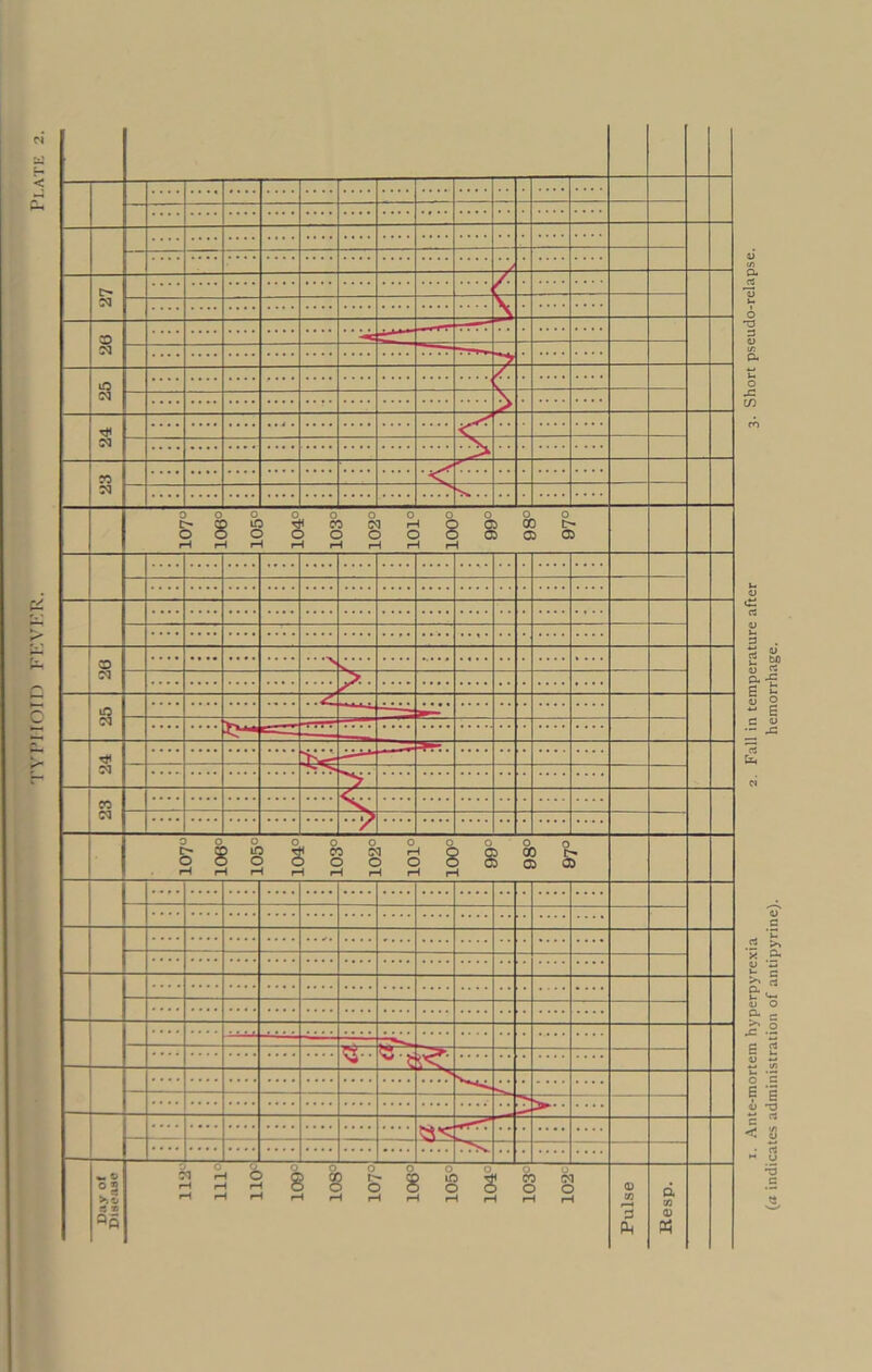 rypirom FeVek. Plate i. Ante-mortem hyperpyrexia 2. Fall in temperature after 3. Short pseudo-relapse. (« indicates administration of antipyrine). hemorrhage.