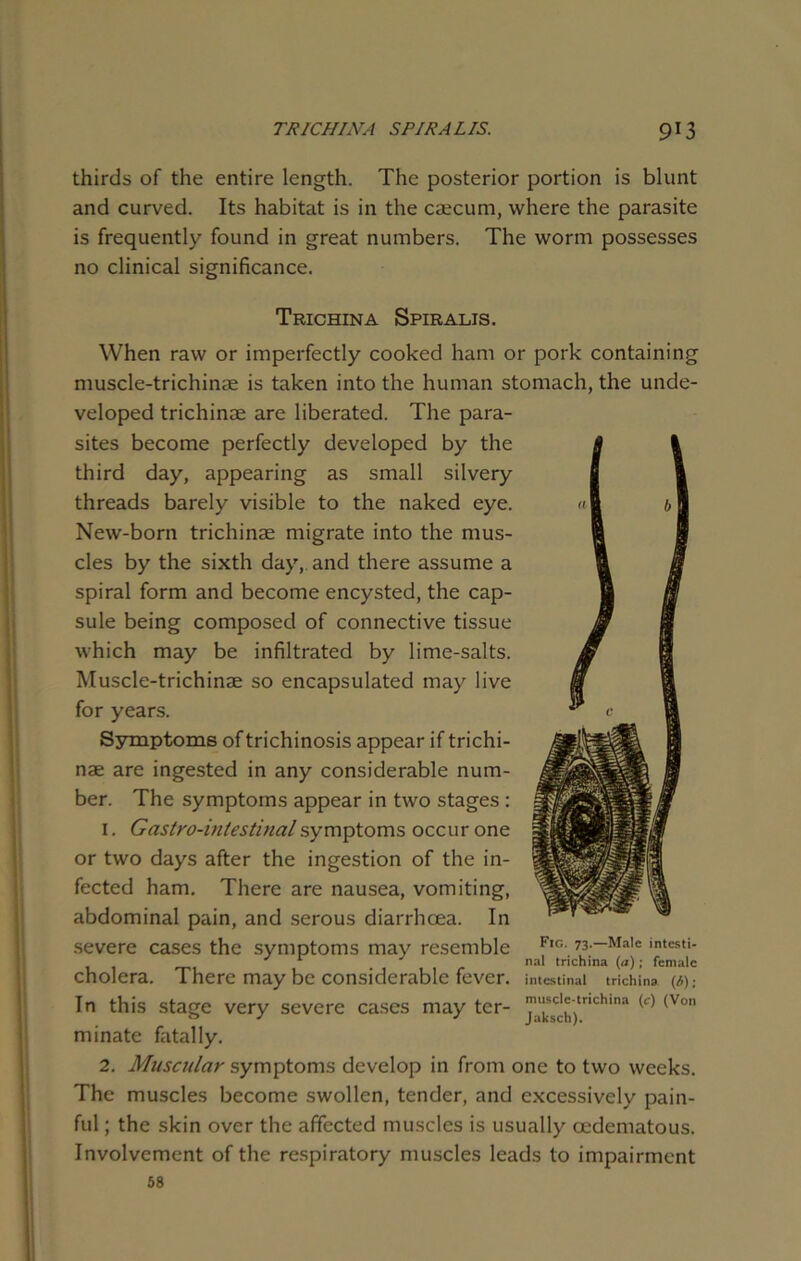 thirds of the entire length. The posterior portion is blunt and curved. Its habitat is in the csecum, where the parasite is frequently found in great numbers. The worm possesses no clinical significance. Trichina Spiralis. When raw or imperfectly cooked ham or pork containing muscle-trichinae is taken into the human stomach, the unde- veloped trichinae are liberated. The para- sites become perfectly developed by the third day, appearing as small silvery threads barely visible to the naked eye. New-born trichinae migrate into the mus- cles by the sixth day, and there assume a spiral form and become encysted, the cap- sule being composed of connective tissue which may be infiltrated by lime-salts. Muscle-trichinae so encapsulated may live for years. Symptoms of trichinosis appear if trichi- nae are ingested in any considerable num- ber. The symptoms appear in two stages : 1. Gastro-intestinal symptoms occur one or two days after the ingestion of the in- fected ham. There are nausea, vomiting, abdominal pain, and serous diarrhoea. In severe cases the symptoms may resemble Fic' 73 —Male intesti- nal trichina (a); female cholera. There may be considerable fever, intestinal trichina (i); In this stage very severe cases may ter- Ja'j£sic(I'jtrlch,na (Vnn minate fatally. 2. Muscular symptoms develop in from one to two weeks. The muscles become swollen, tender, and excessively pain- ful ; the skin over the affected muscles is usually cedematous. Involvement of the respiratory muscles leads to impairment 58