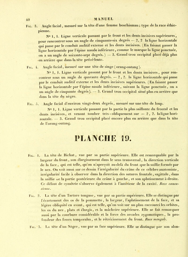 FiG. 3. Angle facial, mesuré sur la tête d'une femme boschisman; type de la race éthio- pienne. N° 1, 1. Ligne verticale passant par le front et les dents incisives supérieures, pour rencontrer sous un angle de cinquante-six degrés — 2, 2 la ligne horizontale qui passe par le conduit auditif externe et les dents incisives. (En faisant passer la ligne horizontale par l'épine nasale inférieure, comme le marque la ligne ponctuée, on a un angle de soixante-sept degrés. ) — 3. Grand trou occipital placé déjà plus en arrière que dans la tète précédente. FiG. 4. Angle facial, mesuré sur une tète de singe (orang-outang). N° 1, 1. Ligne verticale passant par le front et les dents incisives , pour ren- contrer sous un angle de quarante degrés. — 2,2. la ligne horizontale qui passe par le conduit auditif externe et les dents incisives supérieures. ( En faisant passer la ligne horizontale par l'épine nasale inférieure, suivant la ligne ponctuée, on a un angle de cinquante degrés). — 3. Grand trou occipital situé plus en arrière que dans la tète du nègre. FiG. 5. Angle facial d'environ vingt-deux degrés, mesuré sur une tète de loup. N° 1, 1. Ligne verticale passant par la partie la plus saillante du frontal et les dents incisives, et venant tomber très - obliquement sur — 2,2. la ligne hori- zontale. — 3. Grand trou occipital placé encore plus en arrière que dans la tête de l'orang-outang. PLANCHE 19. FiG. 1. La tête de Bichat, vue par sa partie supérieure. Elle est remarquable par la largeur du front, son élargissement dans le sens transversal, la direction verticale de la face , qui est telle, qu'on n'aperçoit au-delà du front que la saillie formée par le nez. On voit aussi sur ce dessin l'irrégularité du crâne de ce célèbre anatomiste, irrégularité facile à observer dans la direction des sutures frontale, sagittale, dans la saillie ue la partie postérieure du crâne à gauche, et son aplatissement à droite. Ce défaut de symétrie s'observe également à l'intérieur de la cavité. Race cauca- sienne. FiG. 2. La tête d'un Tartare tonguse , vue par sa partie supérieure. Elle se distingue par lécartement des os de la pommette, la largeur, l'aplatissement de la face, et sa légère obliquité en avant, qui est telle, qu'on voit sur un plan raccourci les orbites, les os du nez , plats et élargis, et la mâchoire supérieure. Elle se fait remarquer aussi par la courbure considérable et la force des arcades zygomatiques , la pro- fondeur des fosses temporales, et le rétrécissement du front. Race mongole. FiG. 3. La tête d'un Nègre, vue par sa face supérieure. Elle se distingue par son alon-