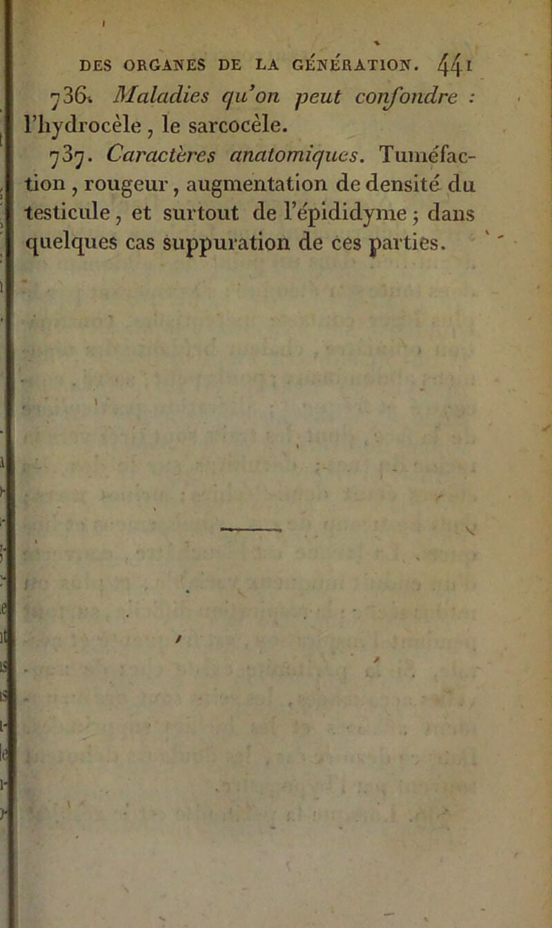 ^36i Maladies qu’on peut confondre : l’hydrocèle, le sarcocèle. q3q. Caractères anatomiques. Tuméfac- tion , rougeur, augmentation de densité du testicule , et surtout de l’épididyme ; dans quelques cas suppuration de ces parties.