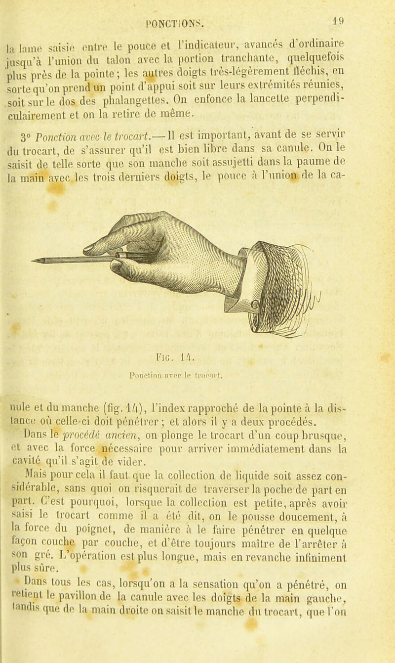 la laine saisie entre le pouce et l'indicateur, avancés d'ordinaire jusqu'à l'union du talon avec la portion tranchante, quelquefois plus près de la pointe; les autres doigts très-légèrement fléchis, en sorte qu'on prend un point d'appui soit sur leurs extrémités réunies, .soit sur le dos des phalangettes. On enfonce la lancette perpendi- culairement et on la retire de môme. 3° Ponction avec le trocart.—W est important, avant de se servir du trocart, de s'assurer qu'il est bien libre dans sa canule. On le saisit de telle sorte que son manche soit assujetti dans la paume de la main avec les trois derniers doigts, le pouce à l'union de la ca- VlG. l'i. l'.inclinn avcr If li iic'ii t. nule et du manche (fig. iU), l'index rapproché de la pointe à la dis- lance où celle-ci doit pénétrer; et alors il y a deux procédés. Dans le procédé ancien, on plonge le trocart d'un coup brusque, et avec la force nécessaire pour arriver immédiatement dans la cavité qu'il s'agit de vider. Mais pour cela il faut que la collection de liquide soit assez con- sidérable, sans quoi on risquerait de traverser la poche de part en part. C'est pourquoi, lorsque la collection est petite, après avoir saisi le trocart comme il a été dit, on le pousse doucement, à la force du poignet, de manière à le faire pénétrer en quelque façon couche par couche, et d'être toujours maître de l'arrêter à son gré. L'opération est plus longue, mais en revanche inliniment plus sûre. * Dans tous les cas, lorsqu'on a la sensation qu'on a pénétré, on retient le pavillon de la canule avec les doigts de la main gauche, tandis que de la main droite on saisit le manche du trocart, que l'on