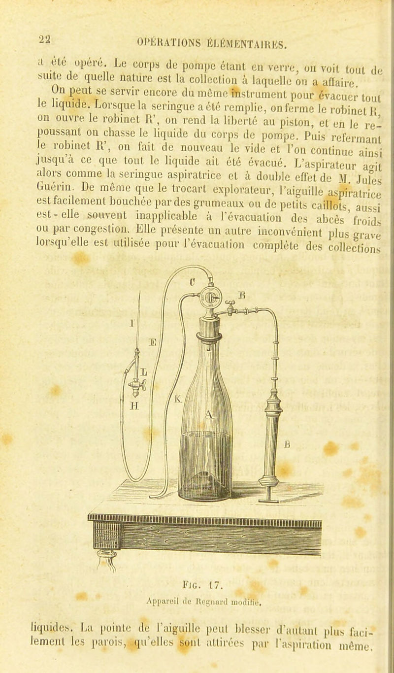 d Ole upei-c Le corps de pompe étant en verre, on voit tout de suite de quelle nature est la collection ù laquelle on a aiïaire On peut se servir encore du même iYistrumenl pour évacuer tout le liquide. Lorsque la seringue a été remplie, on ferme le roijinet Ji on ouvre le robinet R', on rend la liberté au piston, et en Je re- poussant on chasse le liquide du corps de pompe. Puis refermant le robinet R', on fait de nouveau le vide et l'on continue ainsi jusqu'à ce que tout le liquide ait été évacué. L'aspirateur a-^ii alors comme la seringue aspiratrice et à double effet de M Jufes Guérin. De môme que le trocart explorateur, l'aiguille aspiratrice est facilement bouchée par des grumeaux ou de petits caillots aus«i est-elle souvent inapplicable à l'évacuation des abcès'froide ou par congestion. Elle présente un autre inconvénient plus grave lorsqu'elle est utilisée pour l'évacuation complète des collections Fie. 17. Appareil de ni.'giiur(l inodiliù. liquides. La pointe de l'aiguille peul blessci' d'autant plus faci- lement les i»arois, qu'elles sont attirées par Taspiralion inôme