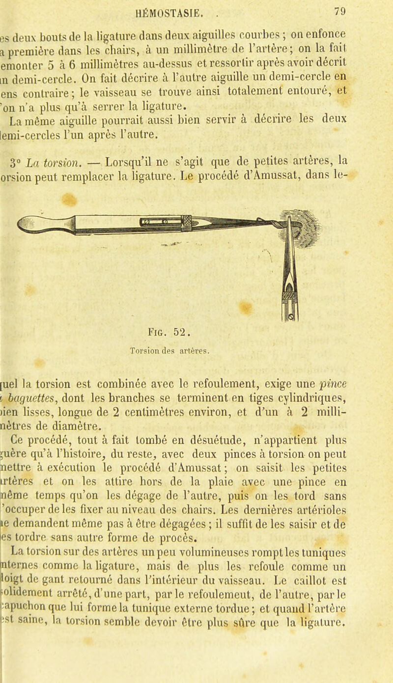 es deux bouts de la ligature dans deux aiguilles courbes ; on enfonce a première dans les chairs, à un millimètre de l'artère; on la fail emonter 5 à 6 millimètres au-dessus et ressortir après avoir décrit in demi-cercle. On fait décrire à l'autre aiguille un demi-cercle en ens contraire; le vaisseau se trouve ainsi totalement entouré, et 'on n'a plus qu'à serrer la ligature. La môme aiguille pourrait aussi bien servir à décrire les deux lemi-cercles l'un après l'autre. 3 La torsion. — Lorsqu'il ne s'agit que de petites artères, la orsionpeut remplacer la ligature. Le procédé d'Amussat, dans le- FiG. 52. Torsion des artèi'es. [uel la torsion est combinée avec le refoulement, exige une pince i baguettes, dont les branches se terminent en tiges cylindriques, )ien lisses, longue de 2 centimètres environ, et d'un à 2 milli- nètres de diamètre. Ce procédé, tout à fait tombé en désuétude, n'appartient plus 5uère qu'à l'histoire, du reste, avec deux pinces à torsion on peut nettre à exécution le procédé d'Amussat ; on saisit les petites irtères et on les attire hors de la plaie avec une pince en Dfiême temps qu'on les dégage de l'autre, puis on les tord sans 'occuper de les fixer au niveau des chairs. Les dernières artérioles ae demandent même pas à être dégagées ; il suffit de les saisir et de les tordre sans autre forme de procès. La torsion sur des artères un peu volumineuses remplies tuniques internes comme la ligature, mais de plus les refoule comme un loigt de gant retourné dans l'intérieur du vaisseau. Le caillot est solidement arrêté, d'une part, parle refoulement, de l'autre, parle capuchon que lui forme la tunique externe tordue ; et quand l'artère ' st saino, k torsion semble devoir être plus sûre que la ligature.