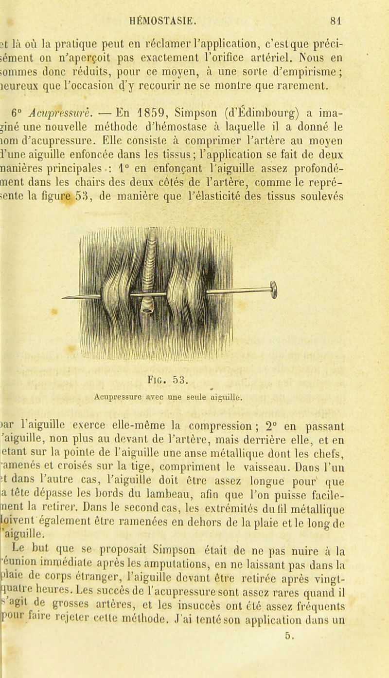 ?t là où la pratique peut en réclamer Tapplication, c'est que préci- sément on n'aperçoit pas exactement rorifice artériel. Nous en sommes donc réduits, pour ce moyen, à une sorte d'empirisme ; leureux que l'occasion d'y recourir ne se montre que rarement. 6 Aciipressitrè. —En 1859, Simpson (d'Edimbourg) a ima- giné une nouvelle méthode d'hémostase à laquelle il a donné le lom d'acupressure. Elle consiste à comprimer l'artère au moyen l'une aiguille enfoncée dans les tissus; l'application se fait de deux nanières principales : 1° en enfonçant l'aiguille assez profondé- ment dans les chairs des deux côtés de l'artère, comme le repré- sente la figure 515, de manière que l'élasticité des tissus soulevés FiG. 53. Acupressure avec une seule aiguille jar l'aiguille exerce elle-même la compression ; 2° en passant 'aiguille, non plus au devant de l'artère, mais derrière elle, et en étant sur la pointe de l'aiguille une anse métallique dont les chefs, ramenés et croisés sur la tige, compriment le vaisseau. Dans l'un l'.t dans l'autre cas, l'aiguille doit être assez longue pour que latêle dépasse les bords du lambeau, afin que l'on puisse facile- ment la retirer. Dans le second cas, les extrémités dulil métallique loivent également être ramenées en dehors de la plaie et le long de 'aiguille. ^ Le but que se proposait Simpson était de ne pas nuire à la réunion immédiate après les amputations, en ne laissant pas dans la l|)laic de corps étranger, l'aiguille devant être retirée après vingl- |fjualre heures. Les succès de l'acupressure sont assez rares quand il is'agit de grosses artères, et les insuccès ont été assez fréquents Ipour faire rejeter cette méthode. J'ai tenté son application dans un ' 5.