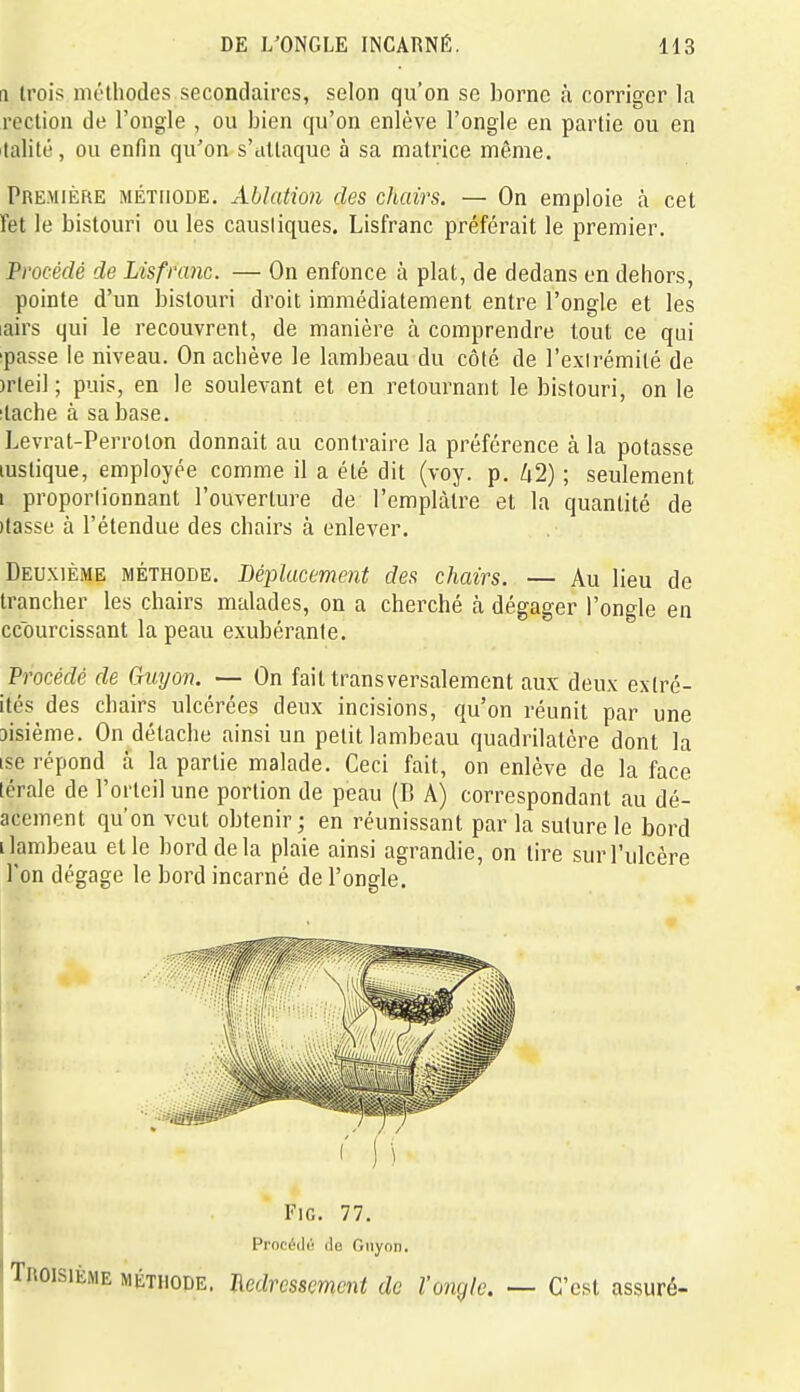 Il trois im'tliodes secondaires, selon qu'on se borne à corriger la roclion de l'ongle , ou bien qu'on enlève l'ongle en partie ou en lalité, ou enfin qu'on s'attaque à sa matrice même. Première méthode. Ablation des chairs. — On emploie à cet Tet le bistouri ou les caustiques. Lisfranc préférait le premier. Procédé de Lisfranc. — On enfonce à plat, de dedans en dehors, pointe d'un bistouri droit immédiatement entre l'ongle et les lairs qui le recouvrent, de manière à comprendre tout ce qui ■passe le niveau. On achève le lambeau du côté de l'exlrémité de )rteil; puis, en le soulevant et en retournant le bistouri, on le itache à sa base. Levrat-Perrolon donnait au contraire la préférence à la potasse lustique, employée comme il a été dit (voy. p. Zi2) ; seulement i proportionnant l'ouverture de l'emplâtre et la quantité de )tasse à l'étendue des chairs à enlever. Deuxième méthode. Déplacement des chairs. — Au lieu de trancher les chairs malades, on a cherché à dégager l'ongle en ccourcissant la peau exubérante. Procédé de Gvyon. — On fait transversalement aux deux extré- ités des chairs ulcérées deux incisions, qu'on réunit par une jisième. On détache ainsi un petit lambeau quadrilatère dont la ise répond à la partie malade. Ceci fait, on enlève de la face lérale de l'orteil une portion de peau (B A) correspondant au dé- acement qu'on veut obtenir; en réunissant par la suture le bord i lambeau et le bord de la plaie ainsi agrandie, on tire sur l'ulcère l'on dégage le bord incarné de l'ongle. Fie. 77. Procédé do Gnyon. Troisième méthode. Jicdrcsscmcnt de l'ongle. — C'est assuré-